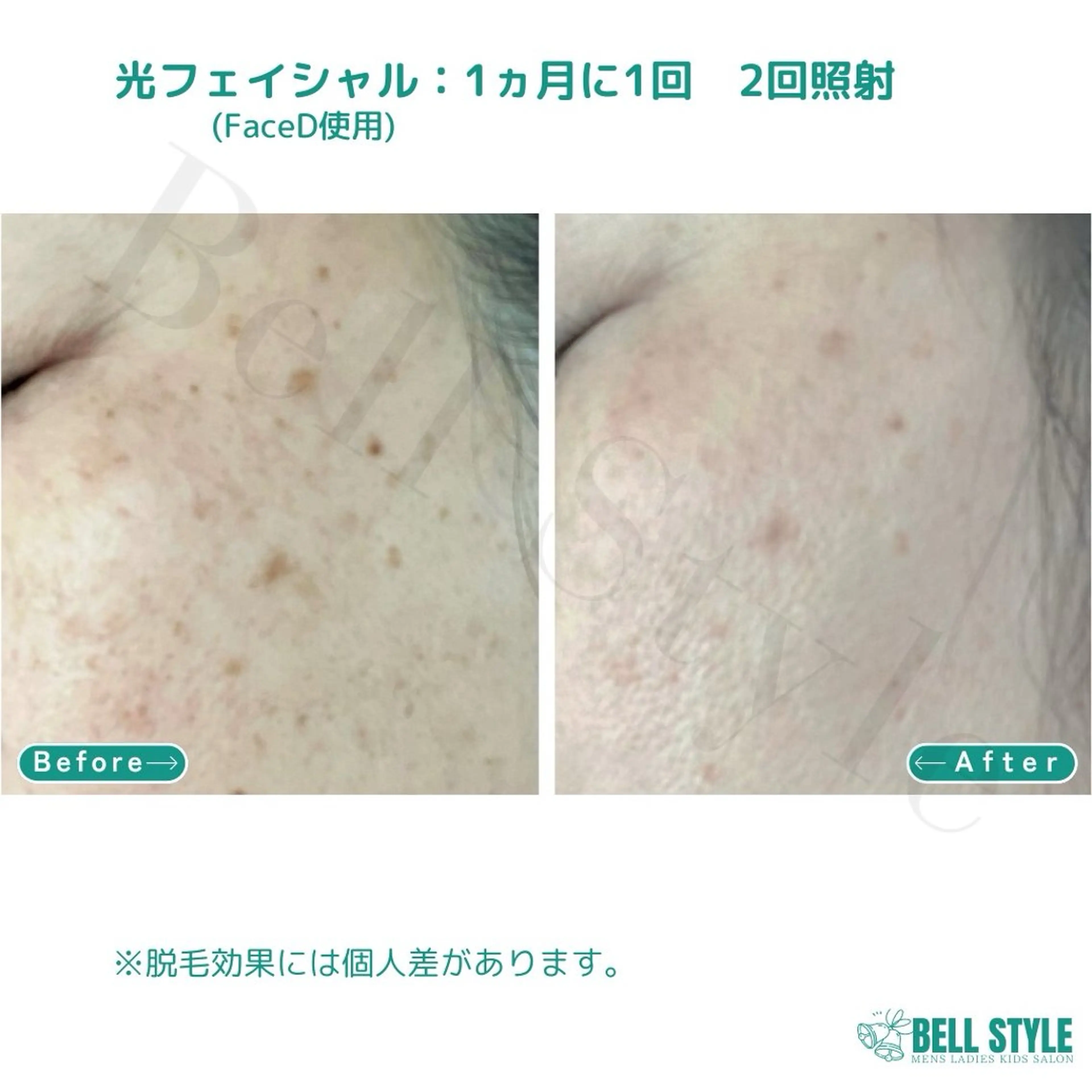 メンズ メンズ&レディース　Bell style所属・【脱毛・美肌専門】 bellstyleのエステ・リラクイメージ