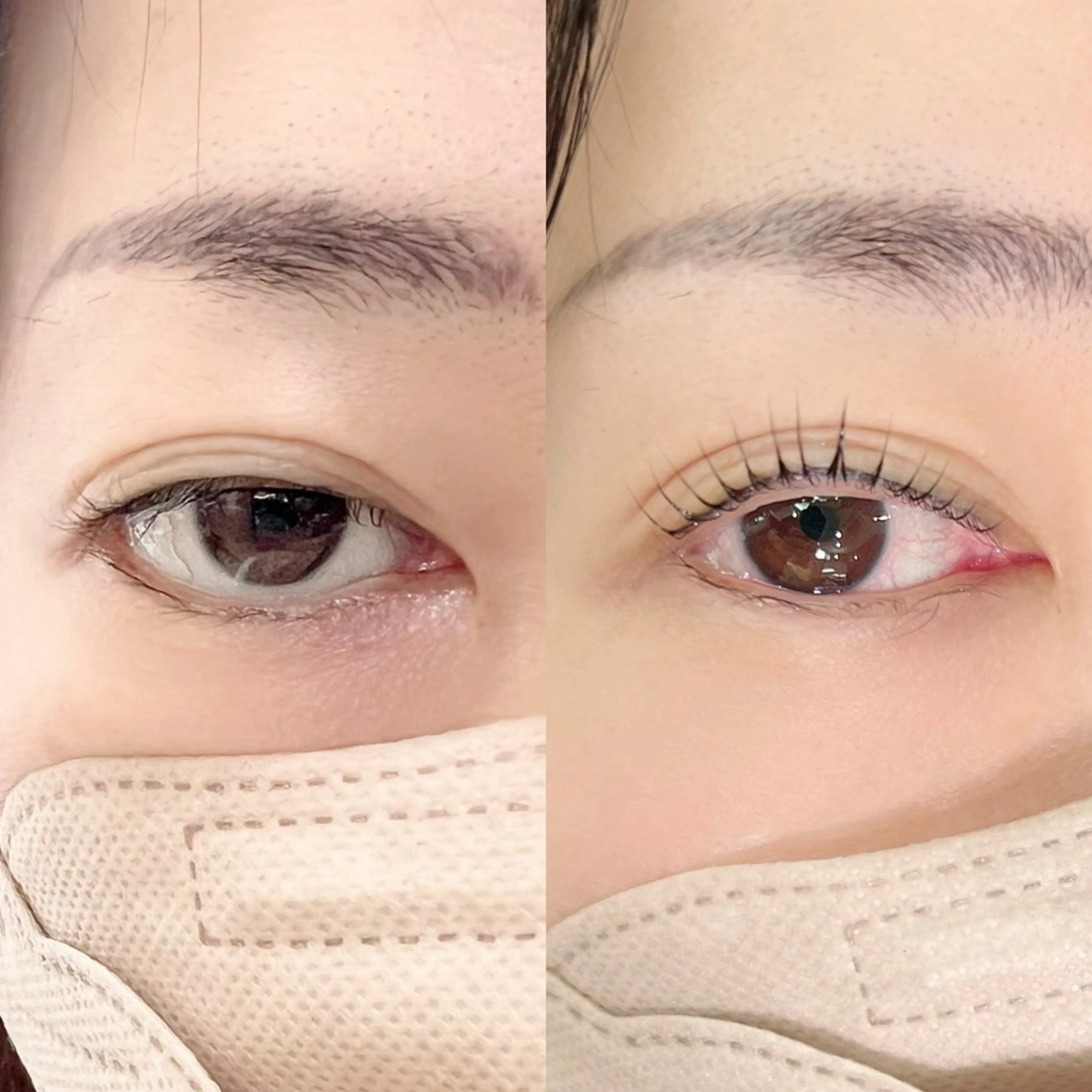 【眼瞼下垂や逆さまつげのメンテナンスに】トリートメント&コーティング付き＼メンズ大歓迎／￥7,150→4,000円の写真