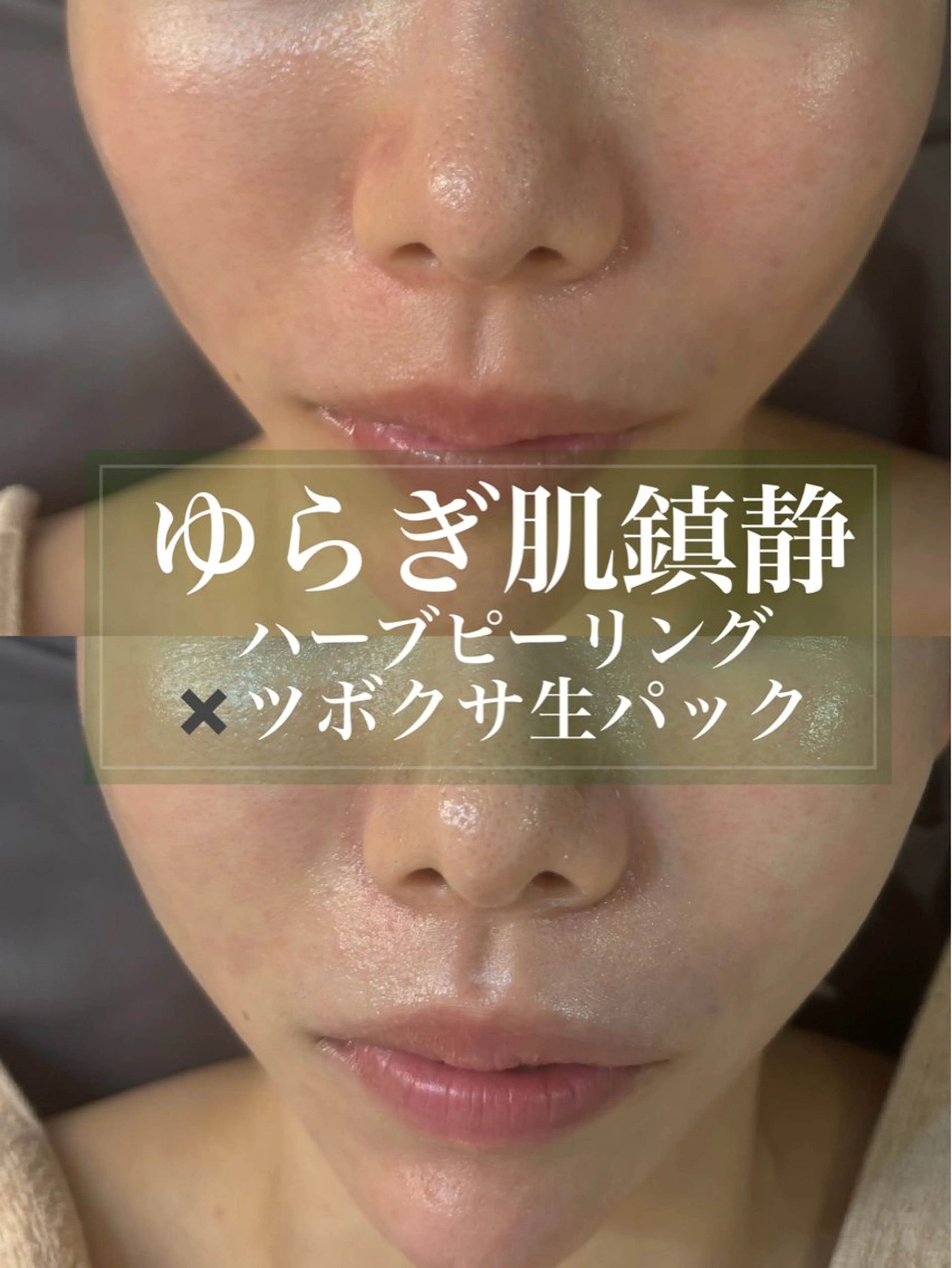 エステ WHITE AQUA 北千住店のエステ・リラクイメージ