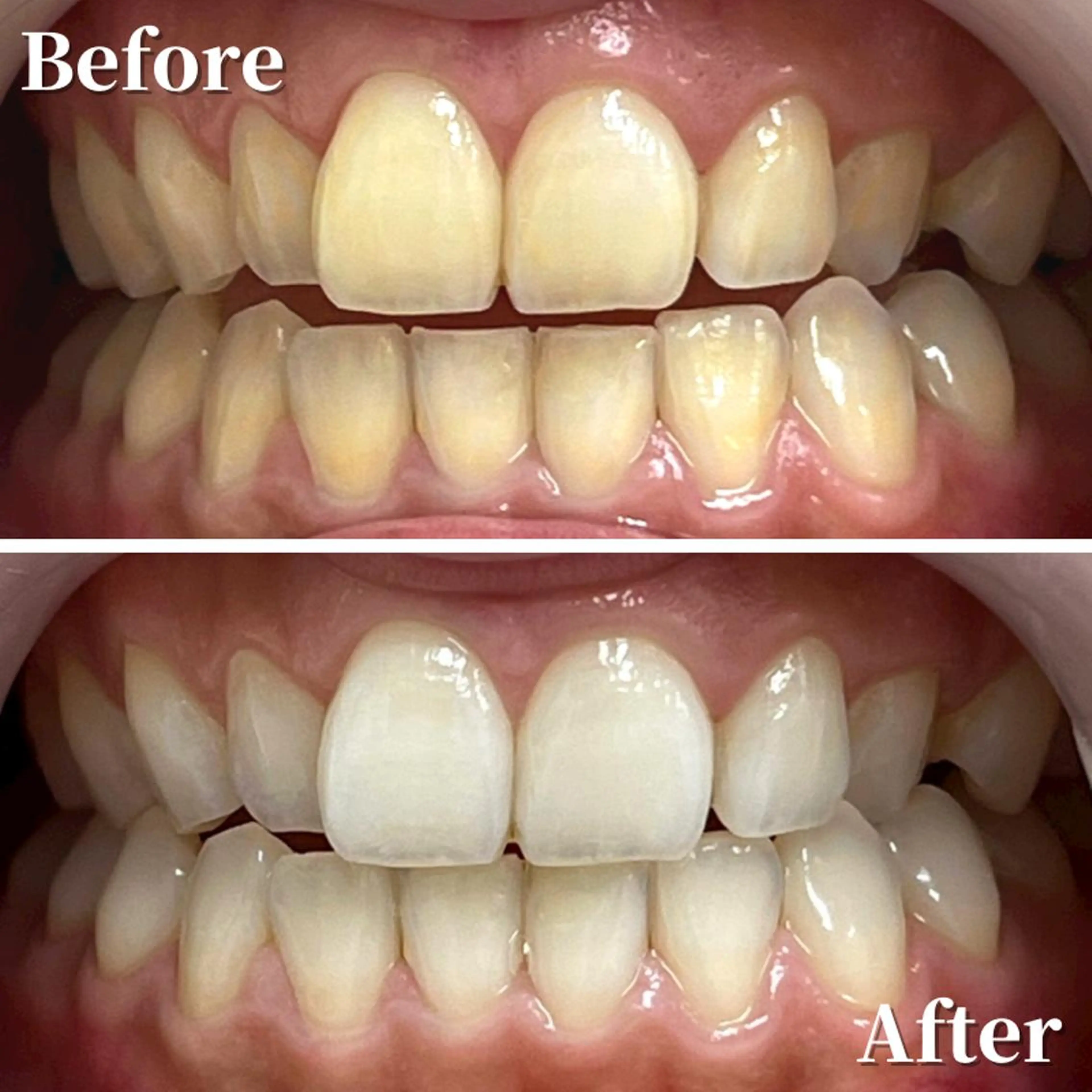 LBSホワイトニング 銀座店💎公式のその他イメージ