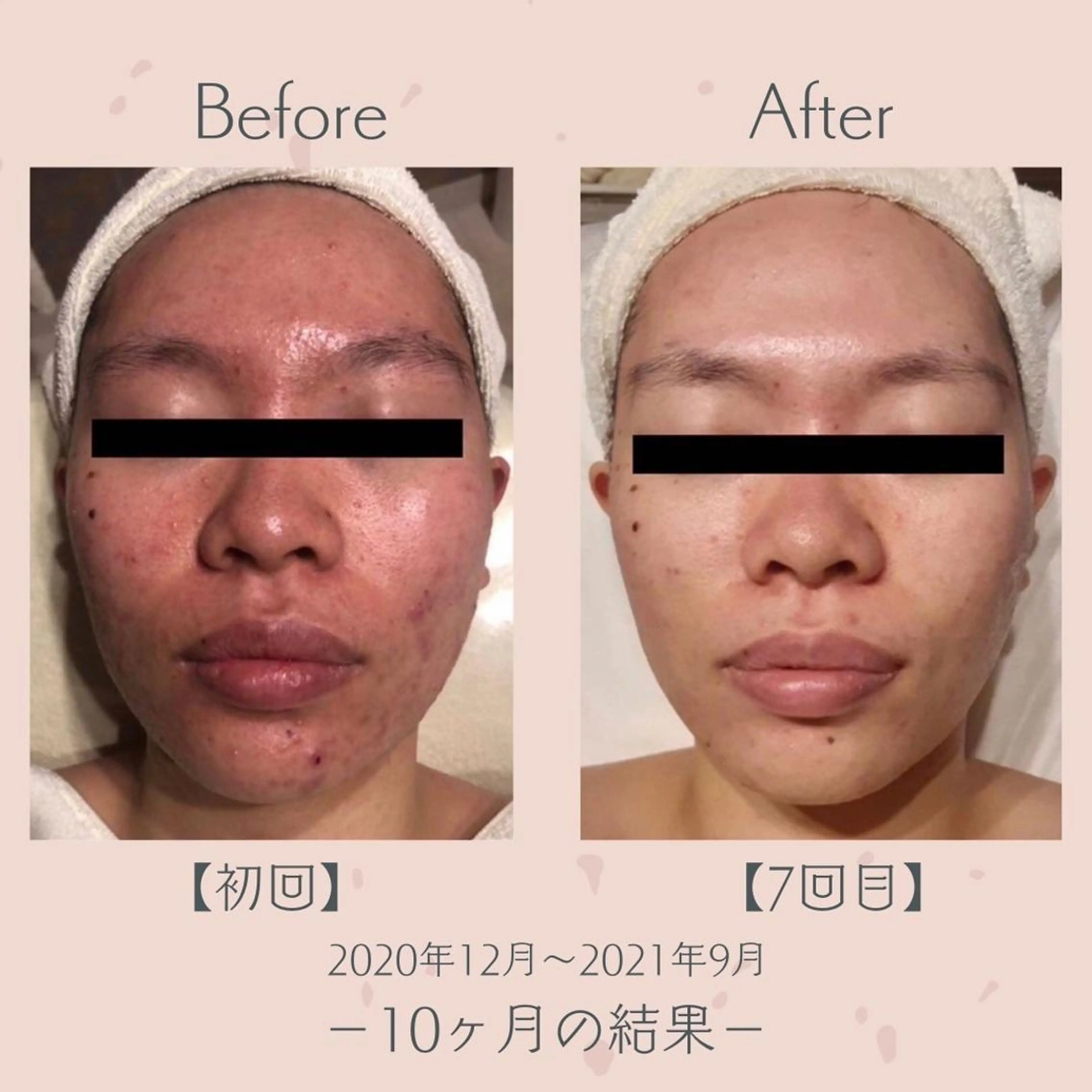 エステツイン広島店 FacialBodyのその他イメージ