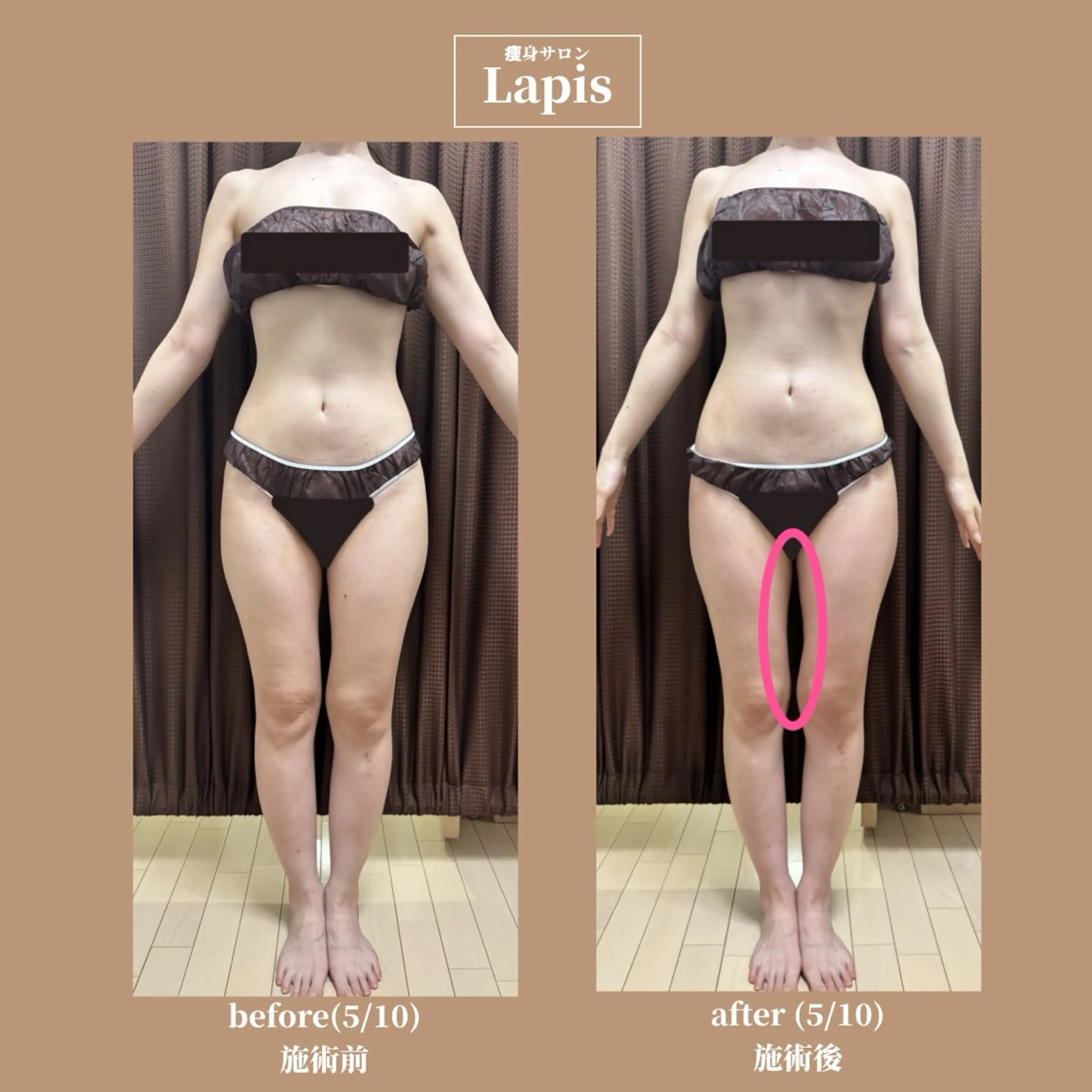 大阪/痩身 〖Lapis〗秋山のエステ・リラクイメージ