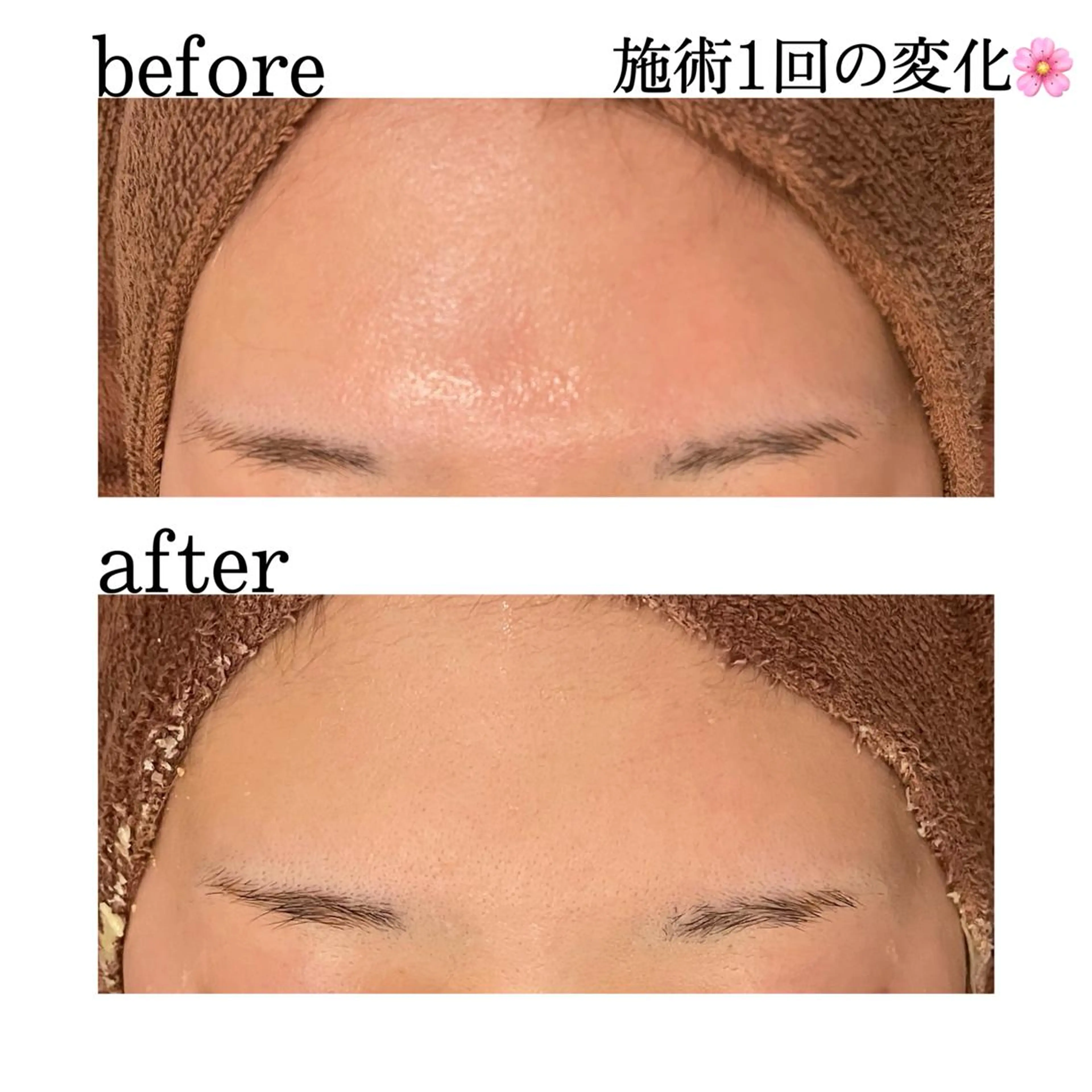 触れたくなる モテ肌へ...❤︎のエステ・リラクイメージ