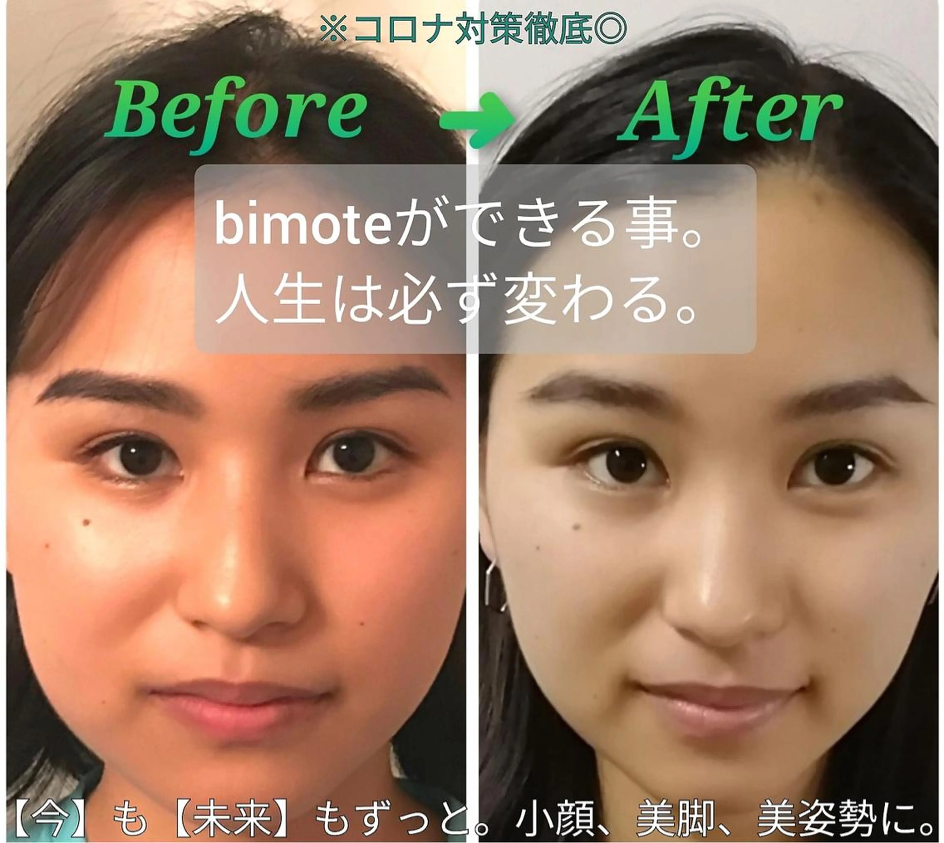 新規女性限定🍀自分史上最高の美人顔に✨フェイシャル整う❗️シワ・毛穴・ニキビケアにも❗️ 小顔＋首肩＋頭蓋骨矯正60分の写真
