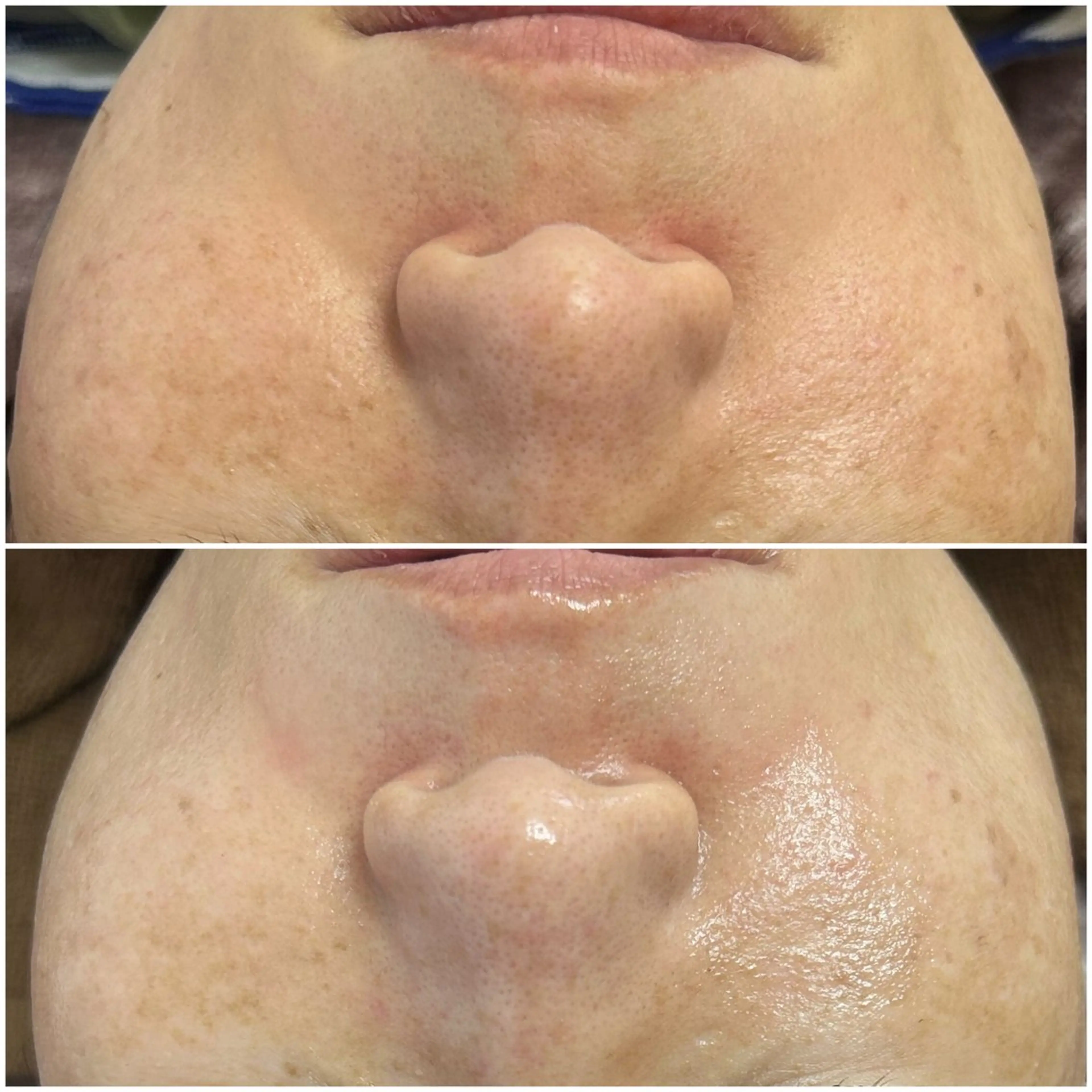 毛穴レス美肌へ🌿 看護師Abe🌼のエステ・リラクイメージ