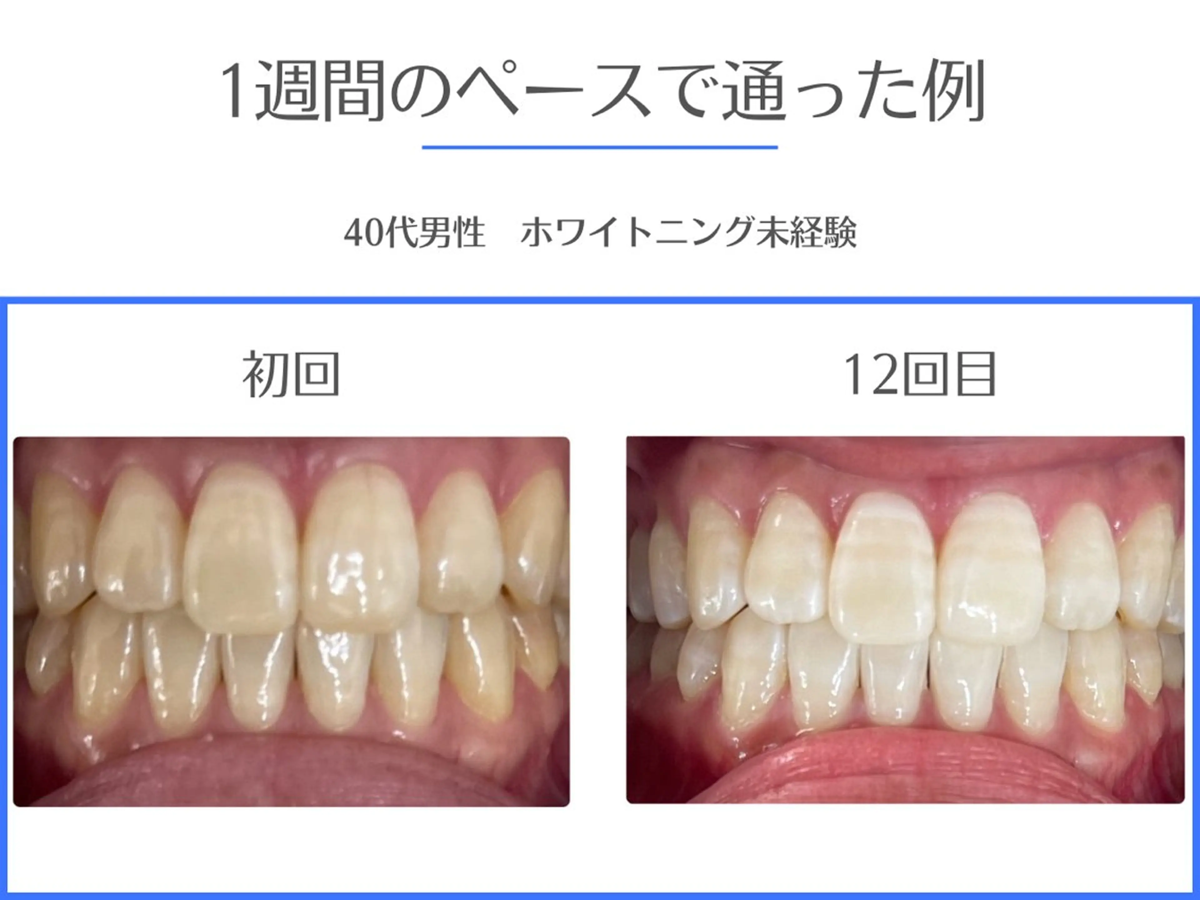 その他 セルフホワイトニング エクシア岡崎店所属・ホワイトニング/脱毛 専門店エクシア岡崎店のその他イメージ