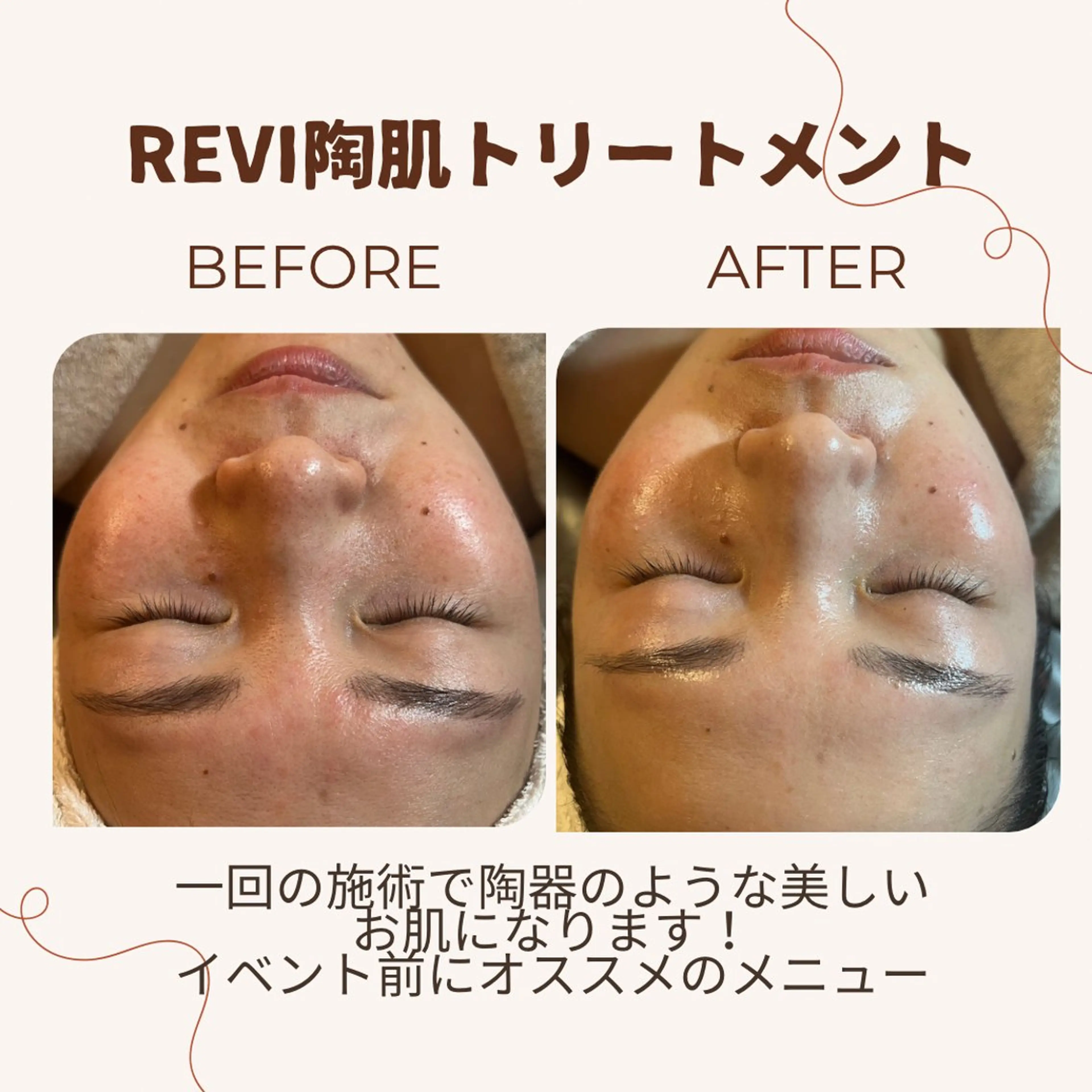 esty hitomiのエステ・リラクイメージ