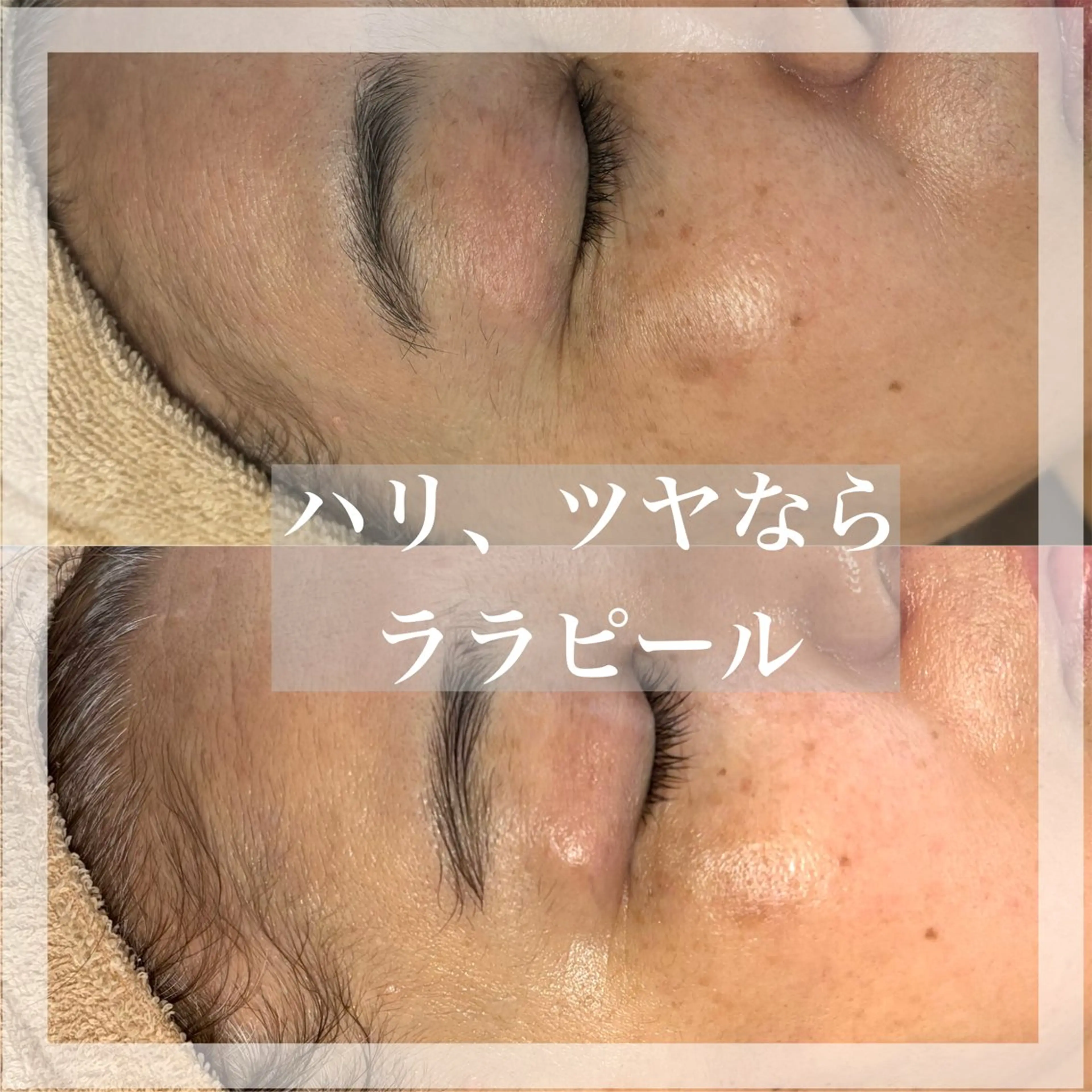 WHITE AQUA 北千住店のエステ・リラクイメージ