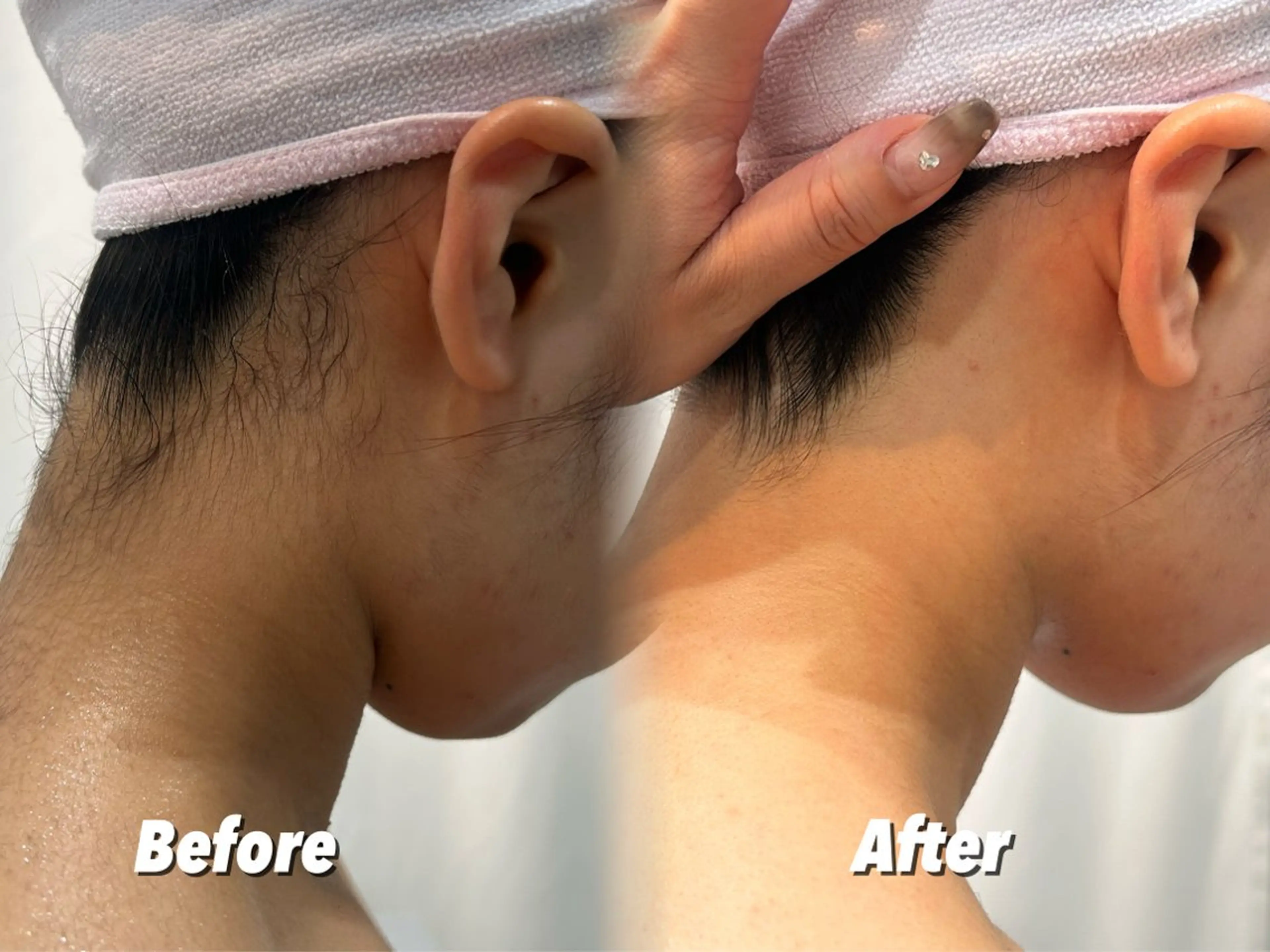 エステ リラク 🫧美しい素肌へ🫧 今成柚乃のその他イメージ