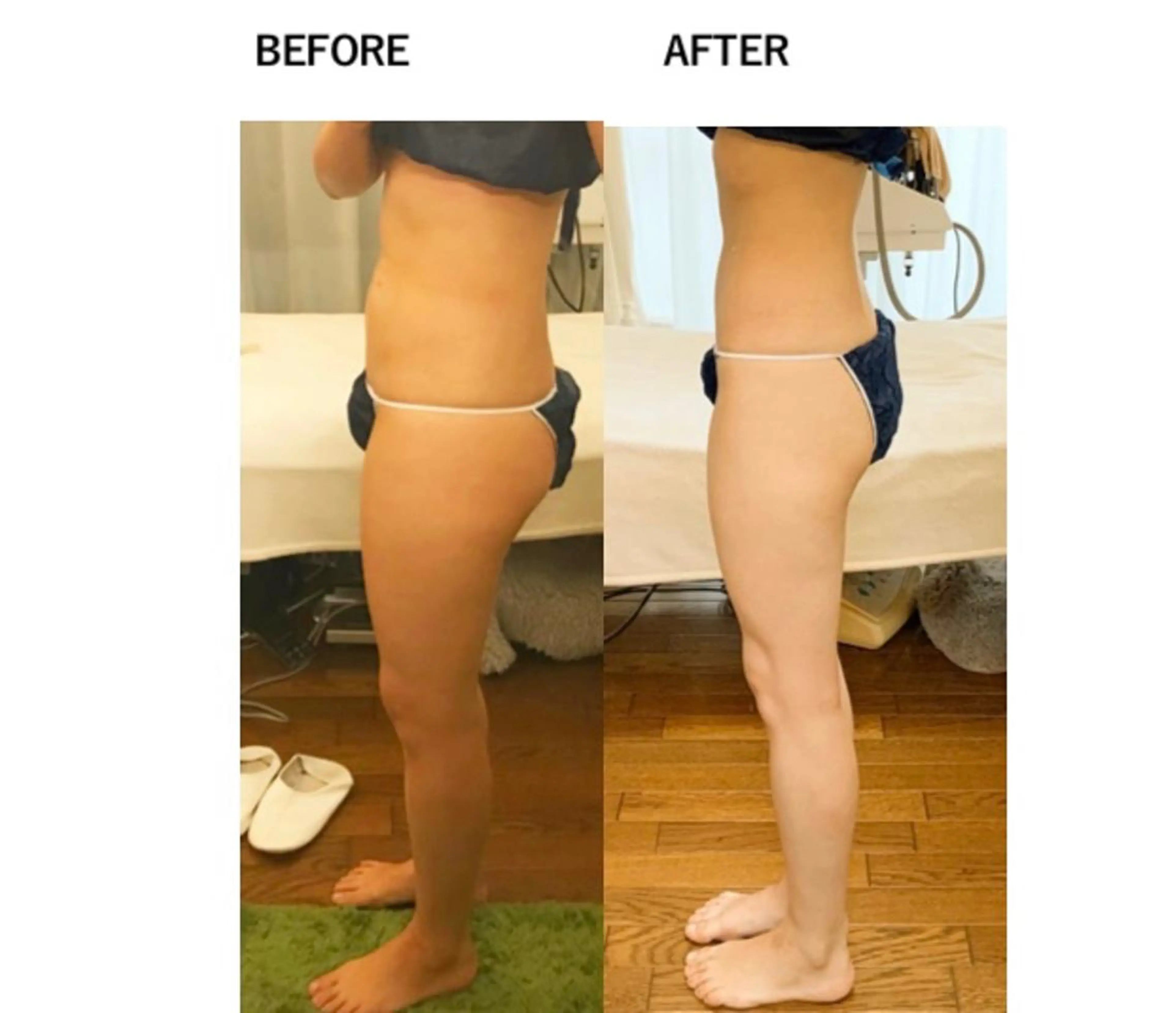 RENsalon大阪 体質改善リトリートのエステ・リラクイメージ