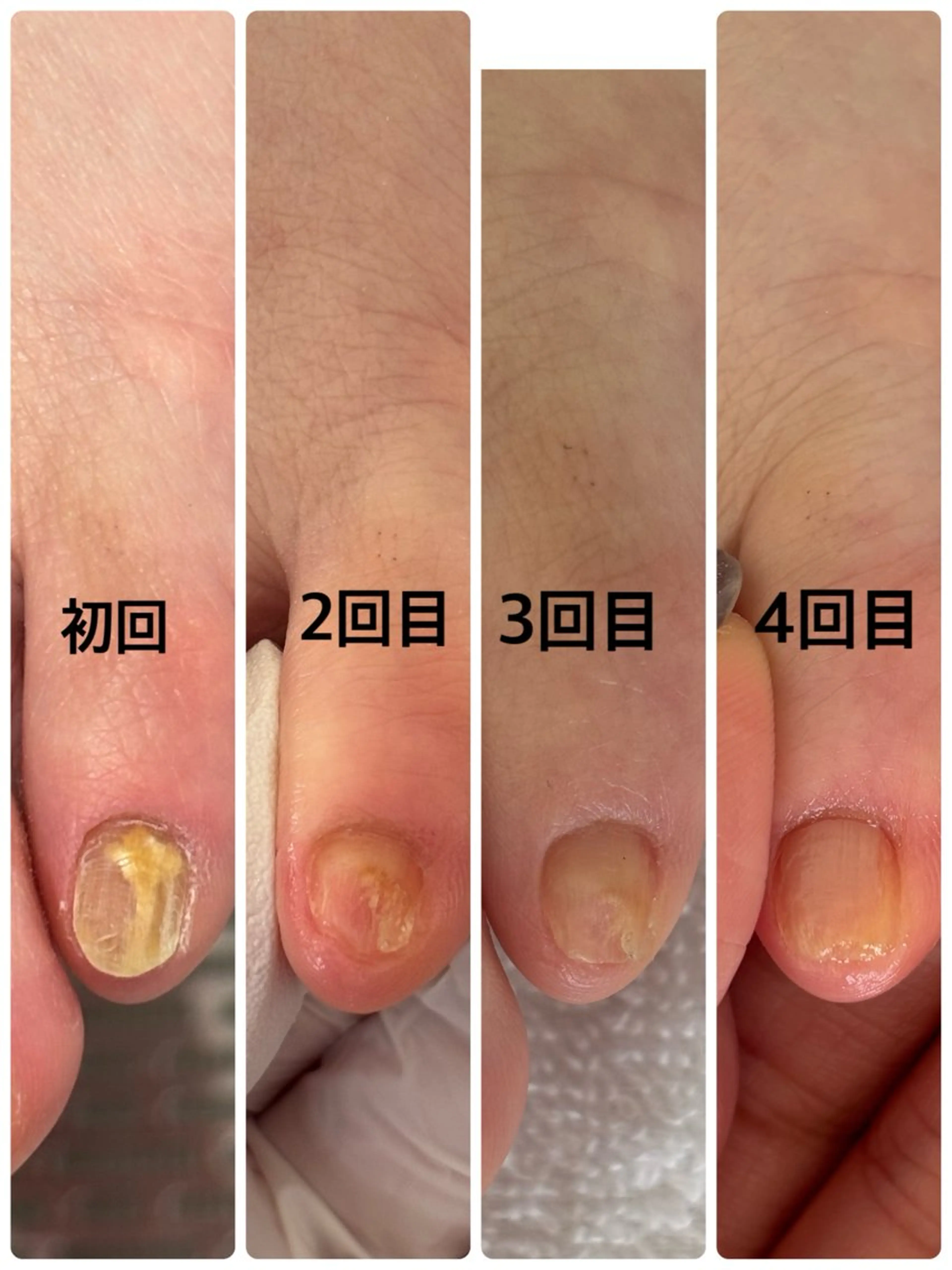 ネイル ハンドネイル フットネイル Alo.nail アロ•ネイルのネイルデザイン