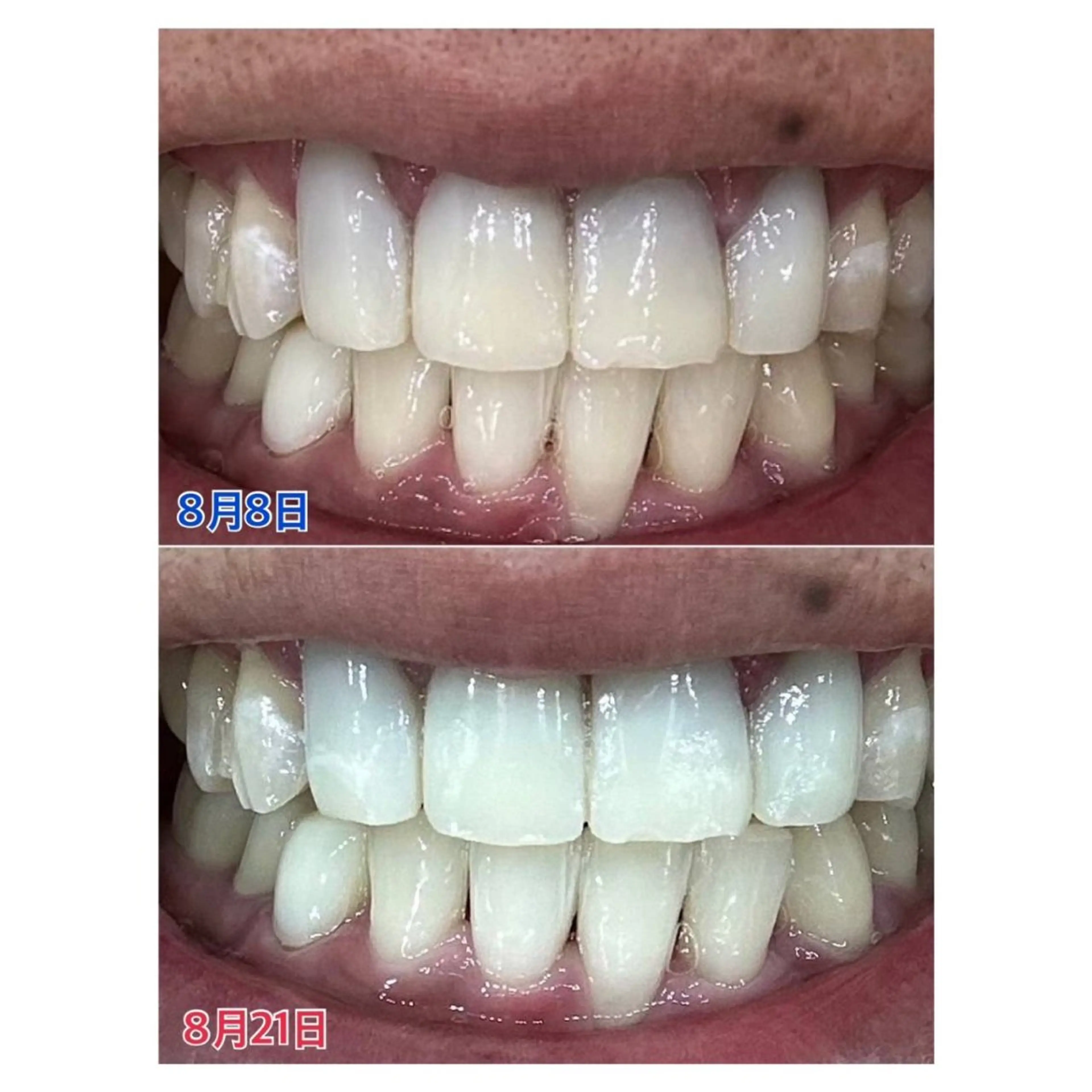 MBEAUTYSALON 千葉店・京成大久保所属・Melty 輝のその他イメージ