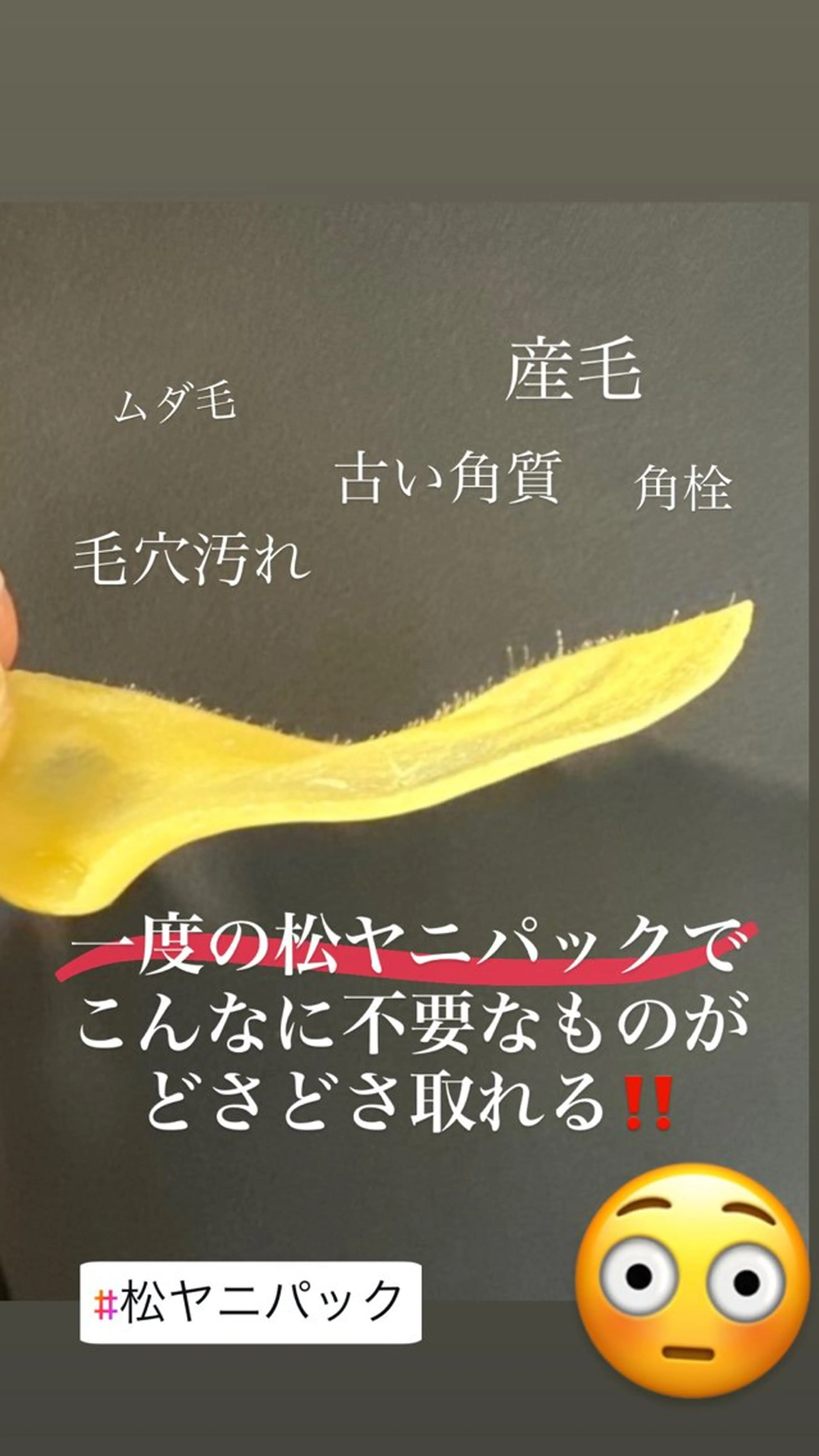 HINA/産毛脱毛・ 肌質改善専門サロンのエステ・リラクイメージ