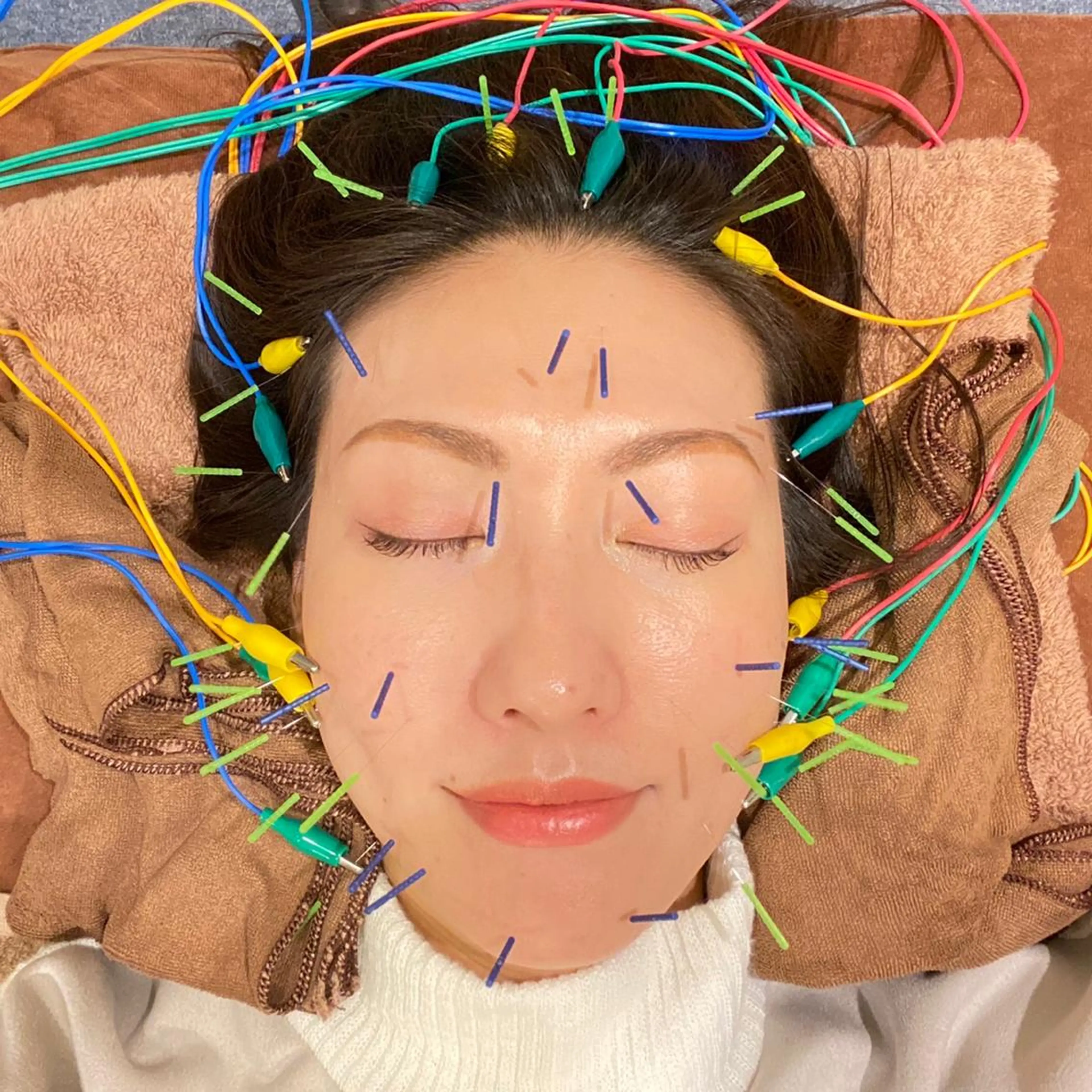 🧸リピーター様🧸✨【 3Dリフト美容鍼】✨(首肩背中ヘッドマッサージ付き) しっかりコリをほぐして行きたい方にお勧めの写真