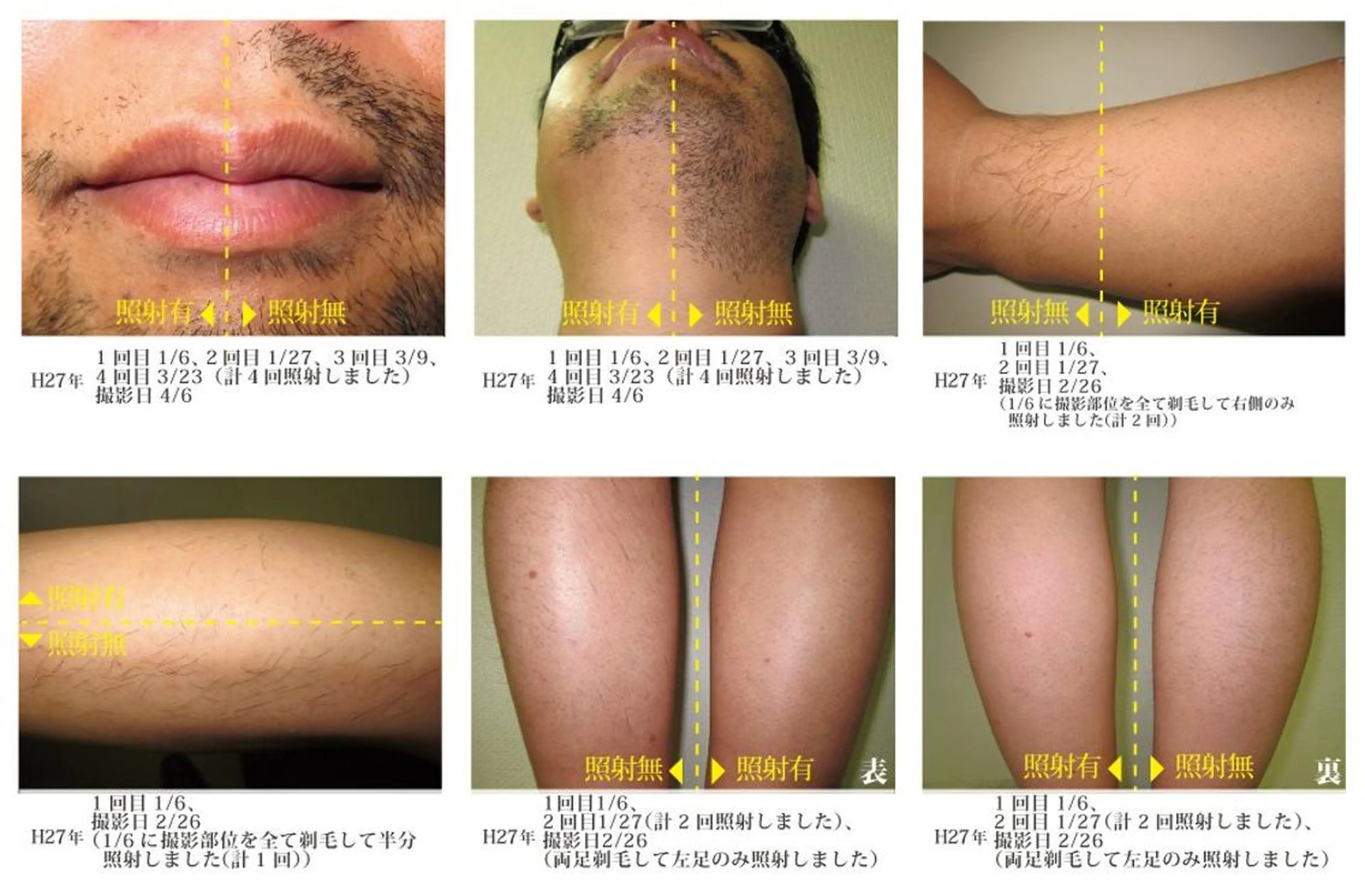 メンズ 脱毛＆エステサロン【アンリミット】所属・森谷 莉美のエステ・リラクイメージ