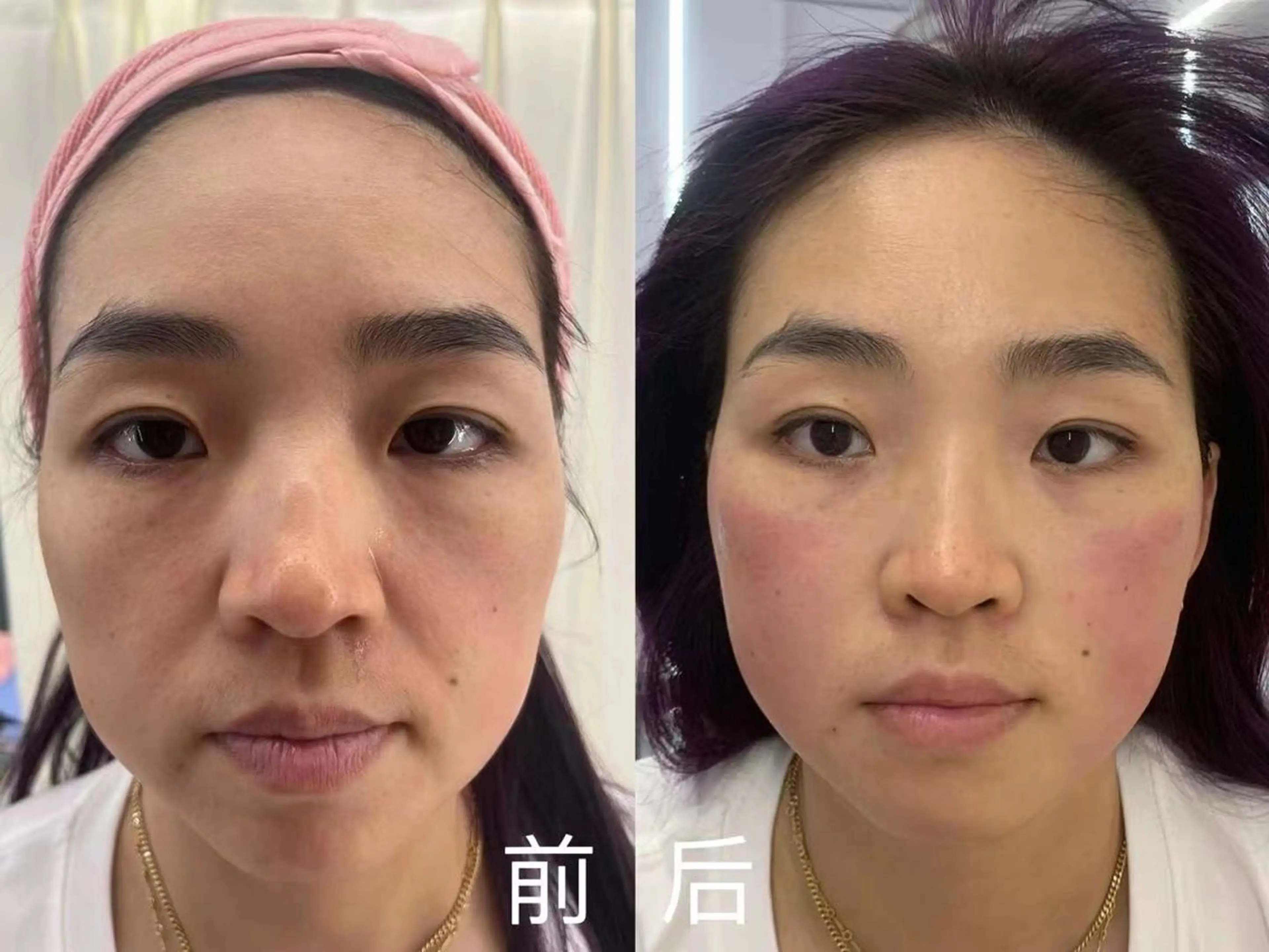 マツエク・マツパ 韓国風マツエク エステ aliaハイフ&水光ジェットサロン所属・aliaハーブ水光店 エステティシャン募集のエステ・リラクイメージ