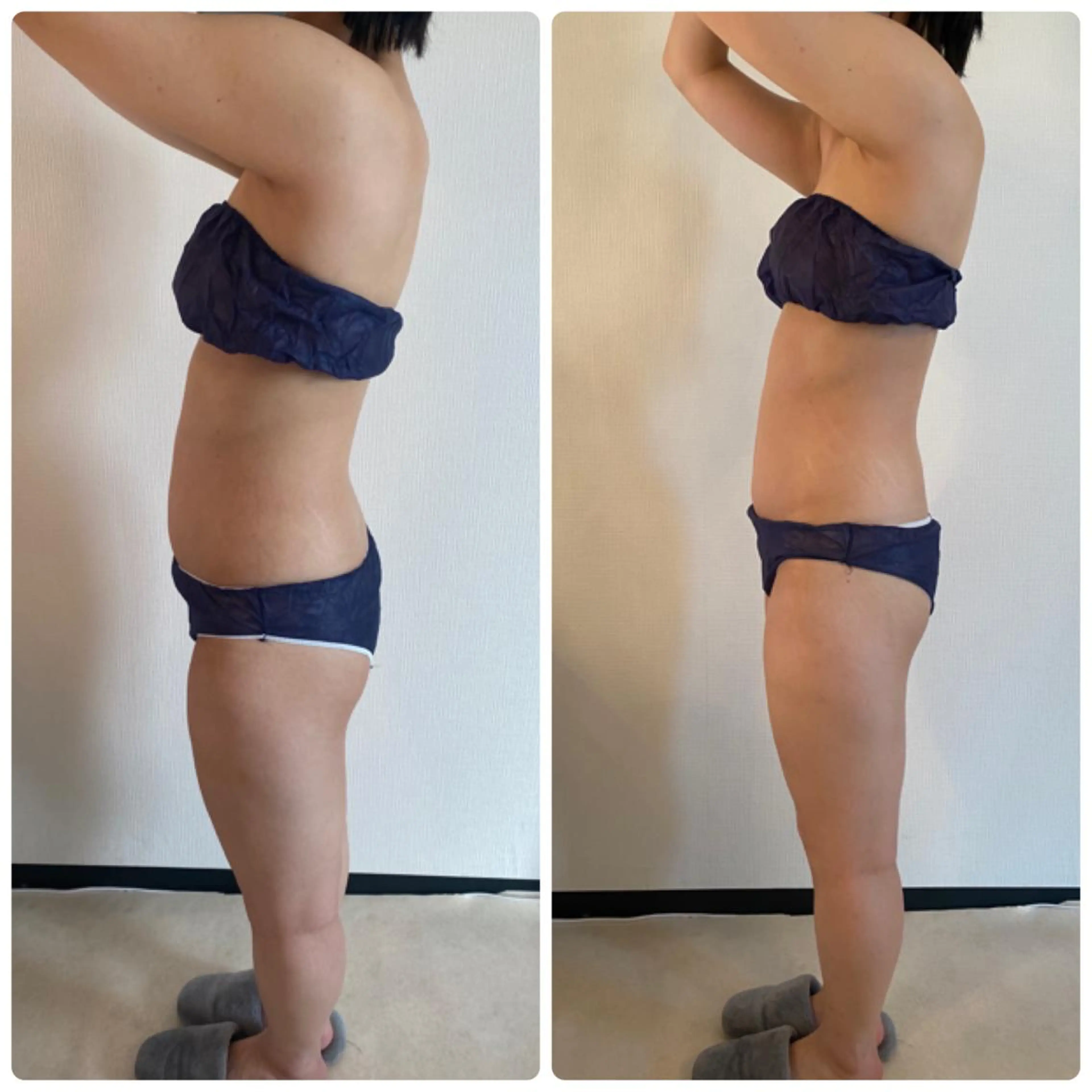 FLEUR大阪・整体 ・ハイフ・痩身・小顔のエステ・リラクイメージ