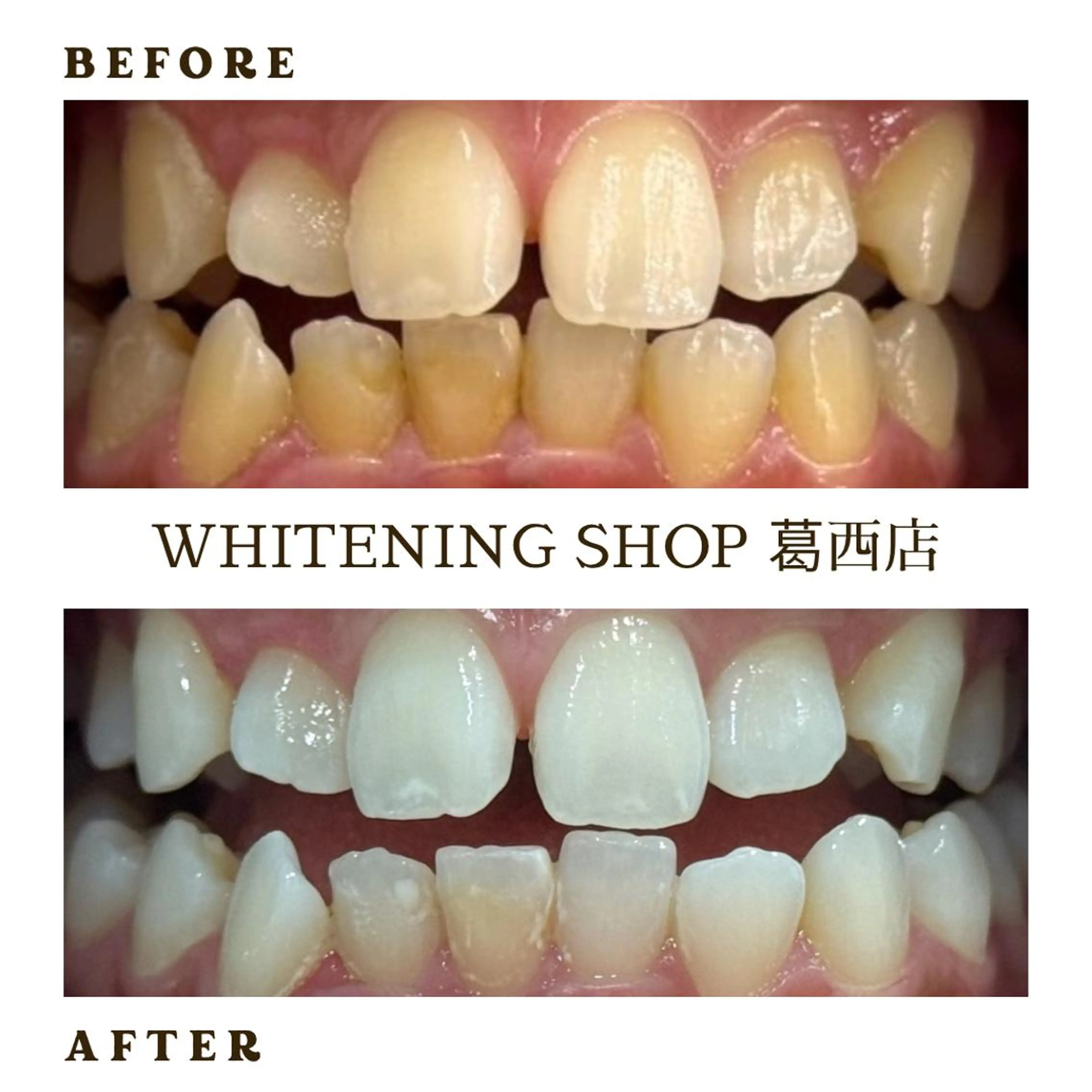 メンズ その他 ホワイトニング ショップ葛西店のその他イメージ