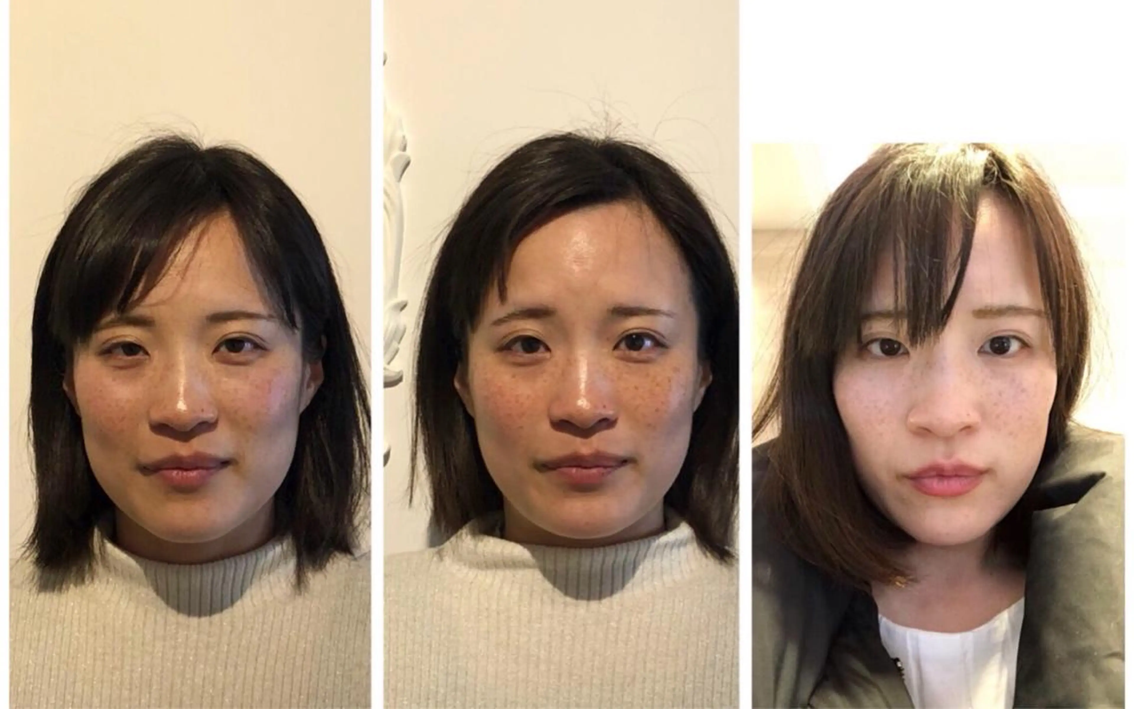 小顔矯正専門サロンジュマリ所属・町田 淳子のエステ・リラクイメージ