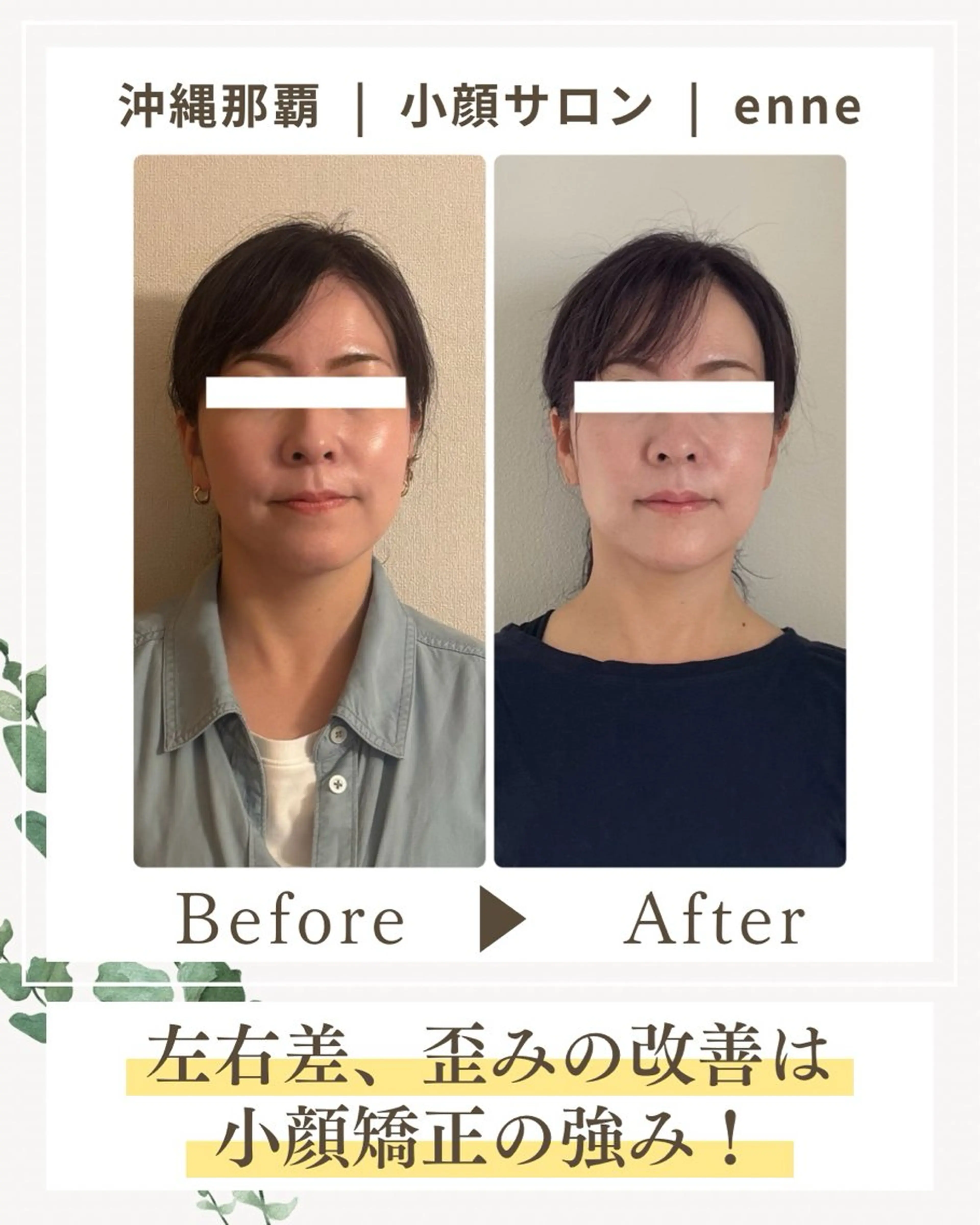 その他 小顔サロンenne所属・小顔サロンenne 【エンネ】のその他イメージ