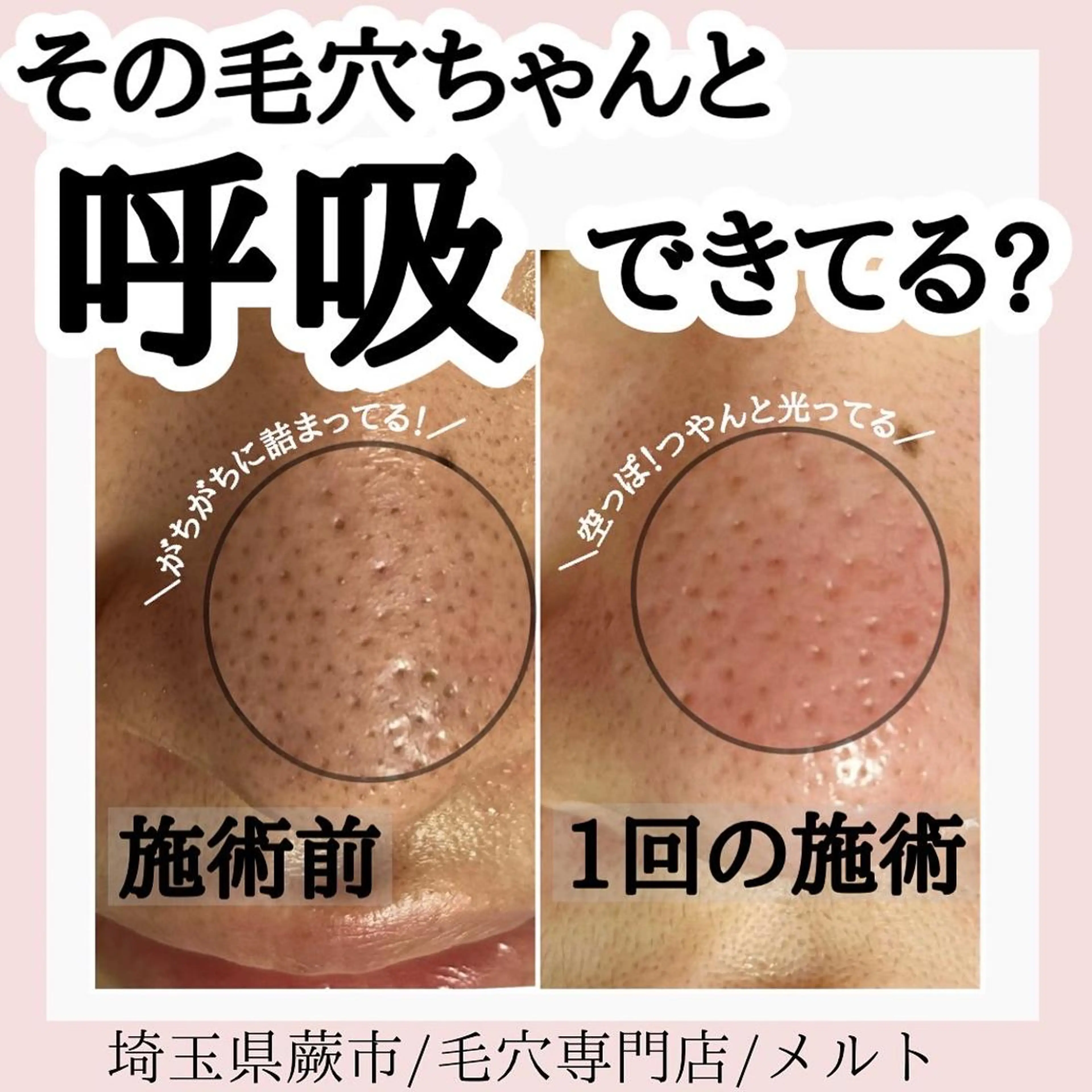 エステ melt まみのマツエク・マツパデザイン