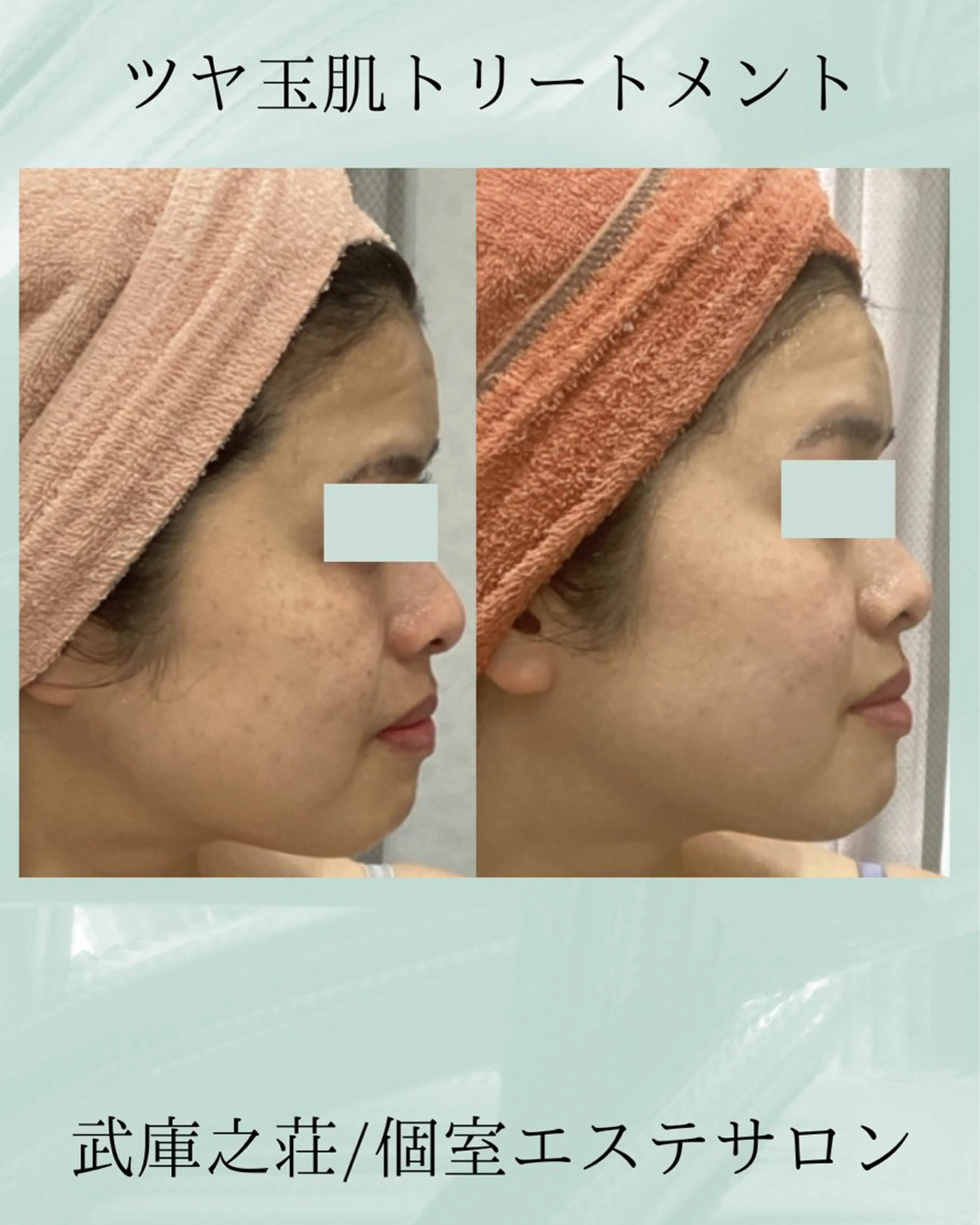 エステ♡Eden Asamiのエステ・リラクイメージ