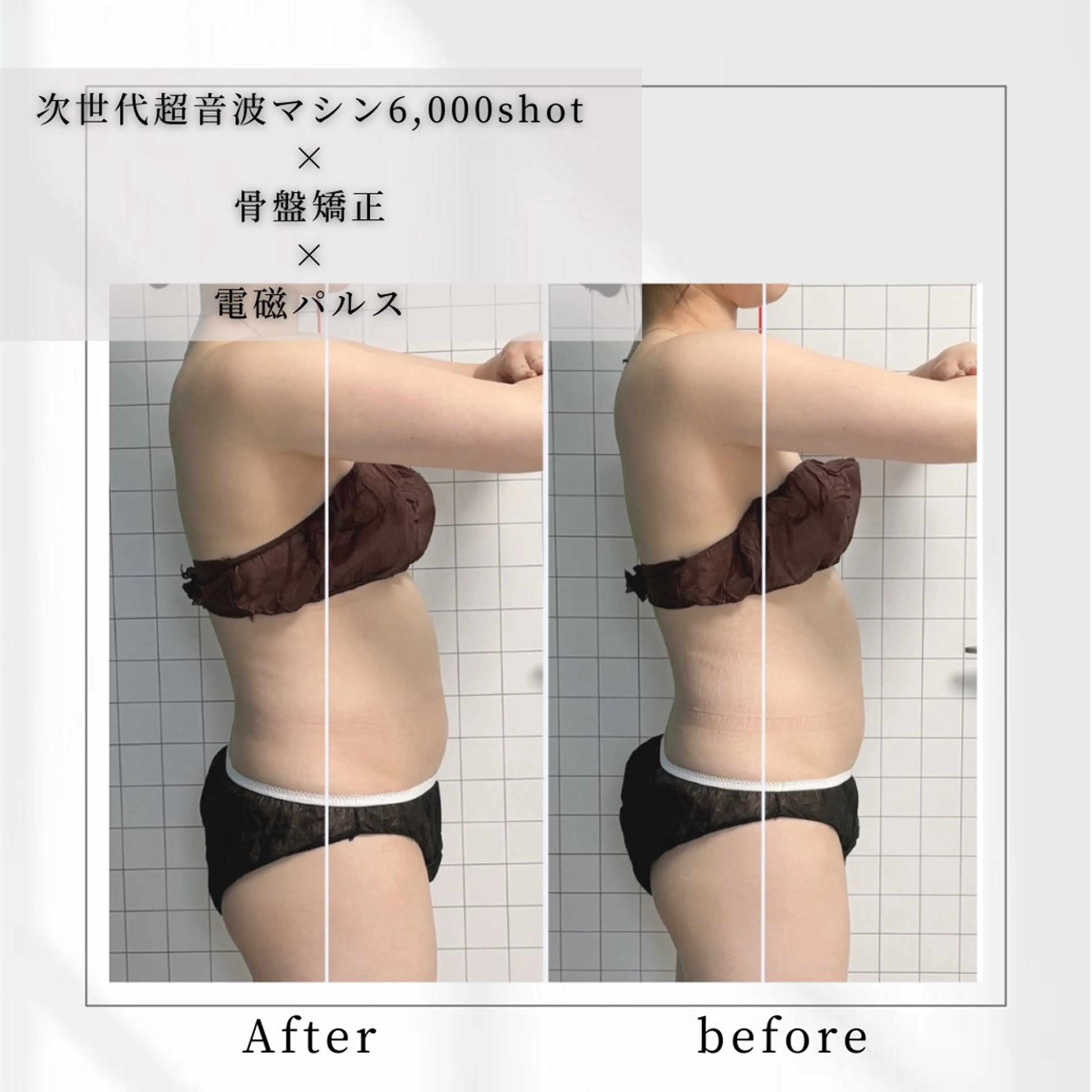 小顔矯正専門店 【RED】池田のエステ・リラクイメージ