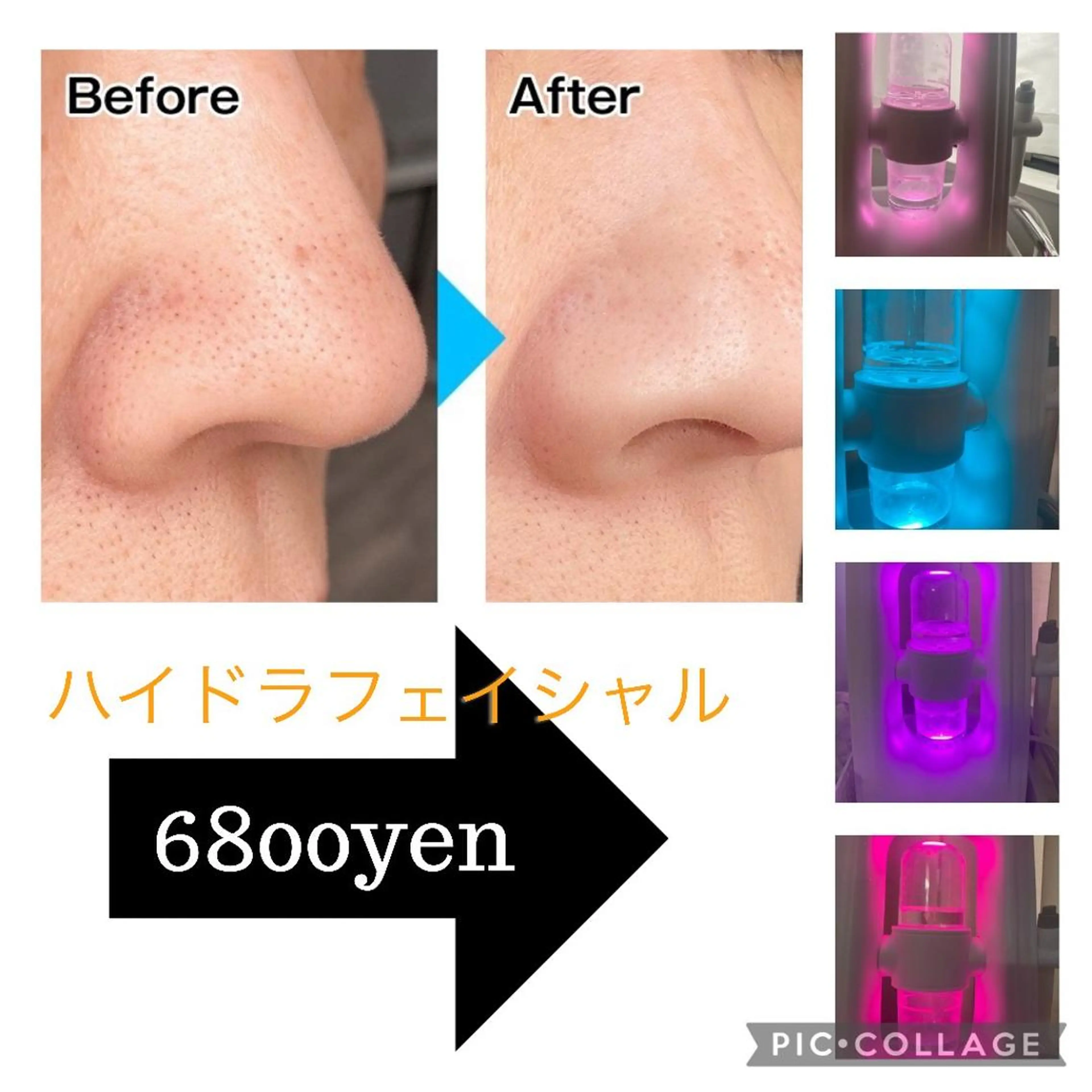 VERY VERY九条店所属・VERYVERY🌹 ビューティーサロンのエステ・リラクイメージ