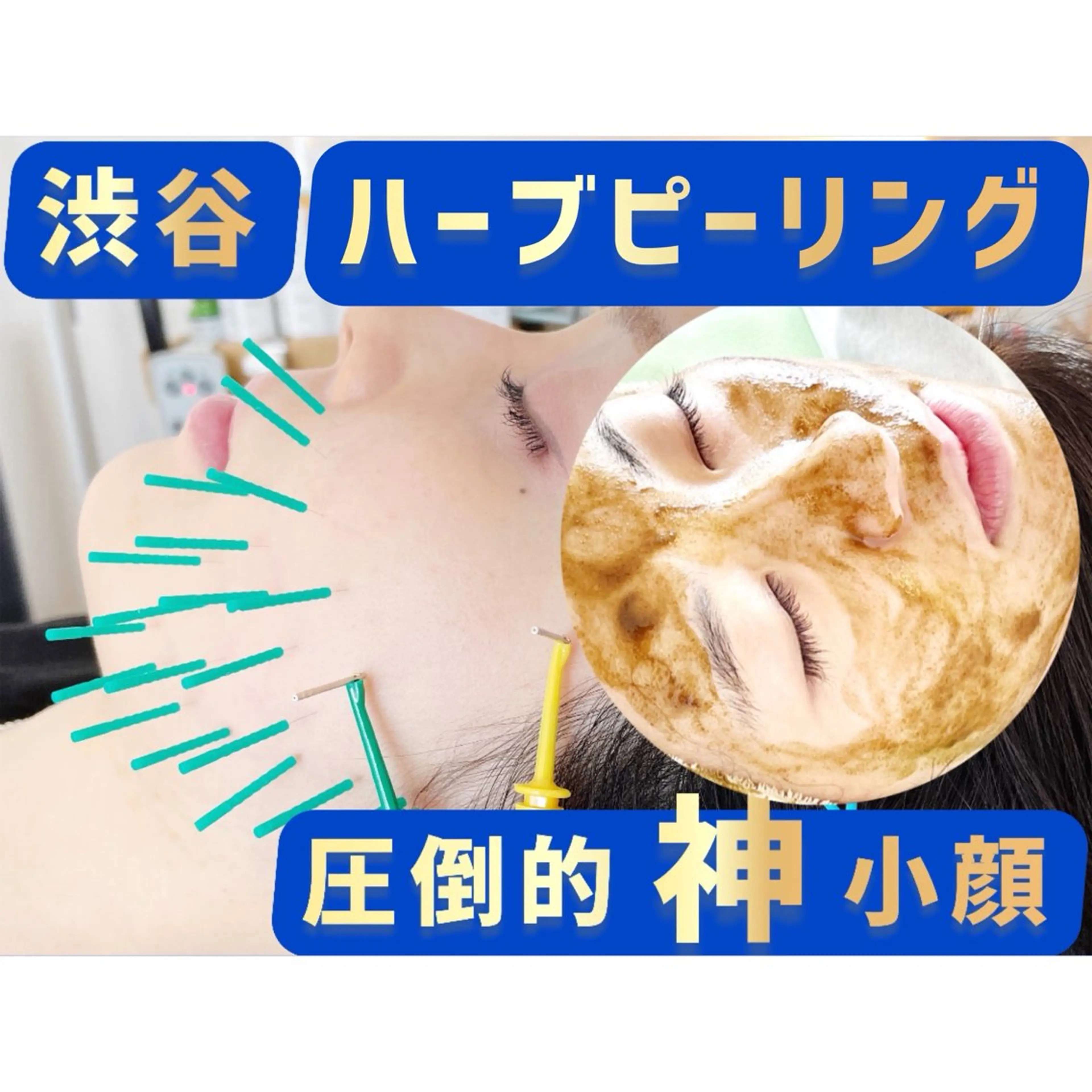 エステ リラク 小顔美容鍼専門サロン 渋谷YZのエステ・リラクイメージ