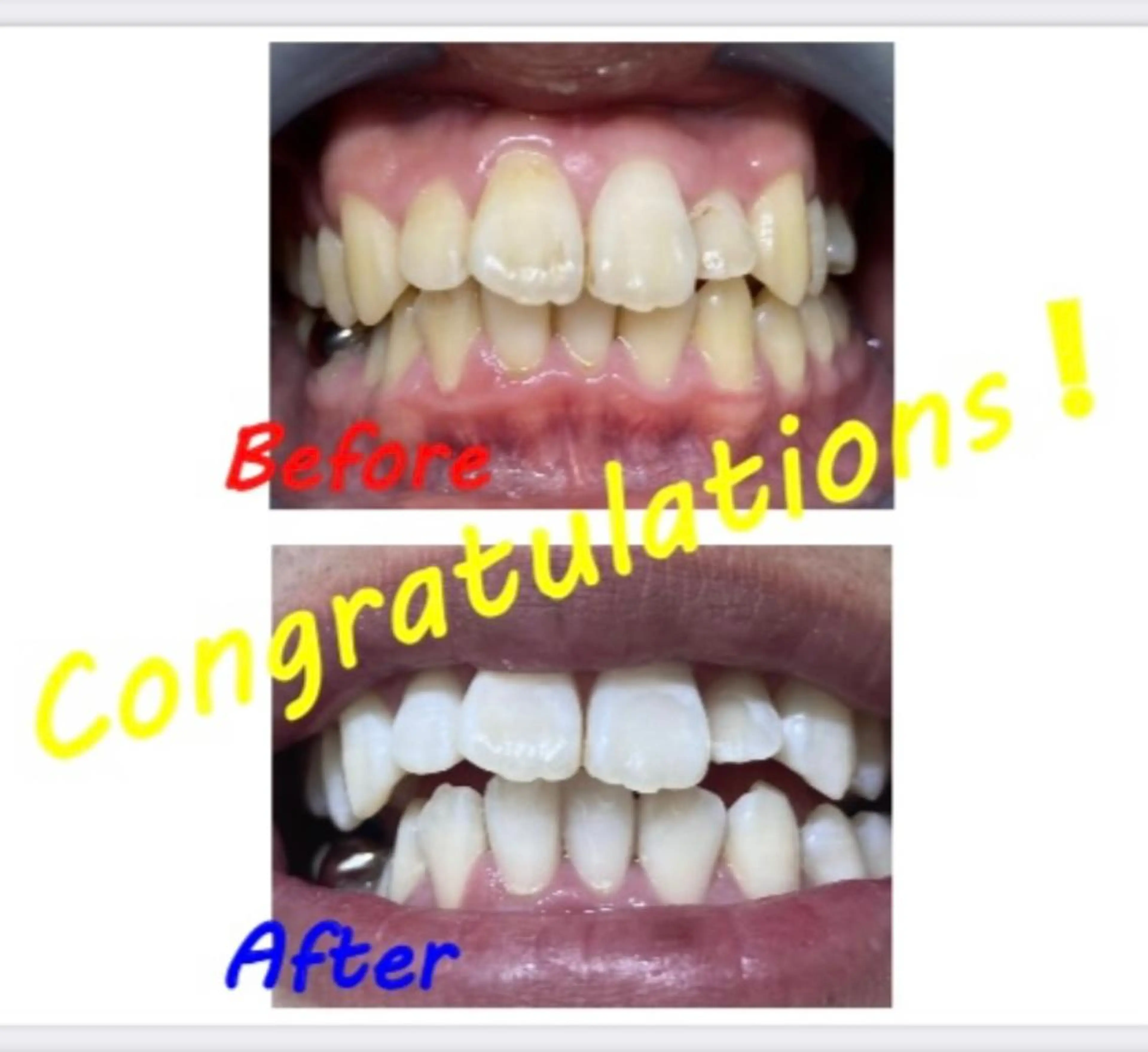 その他 セルフホワイトニングサロン　ラヴィアン所属・ホワイトニングサロン La vie enのその他イメージ