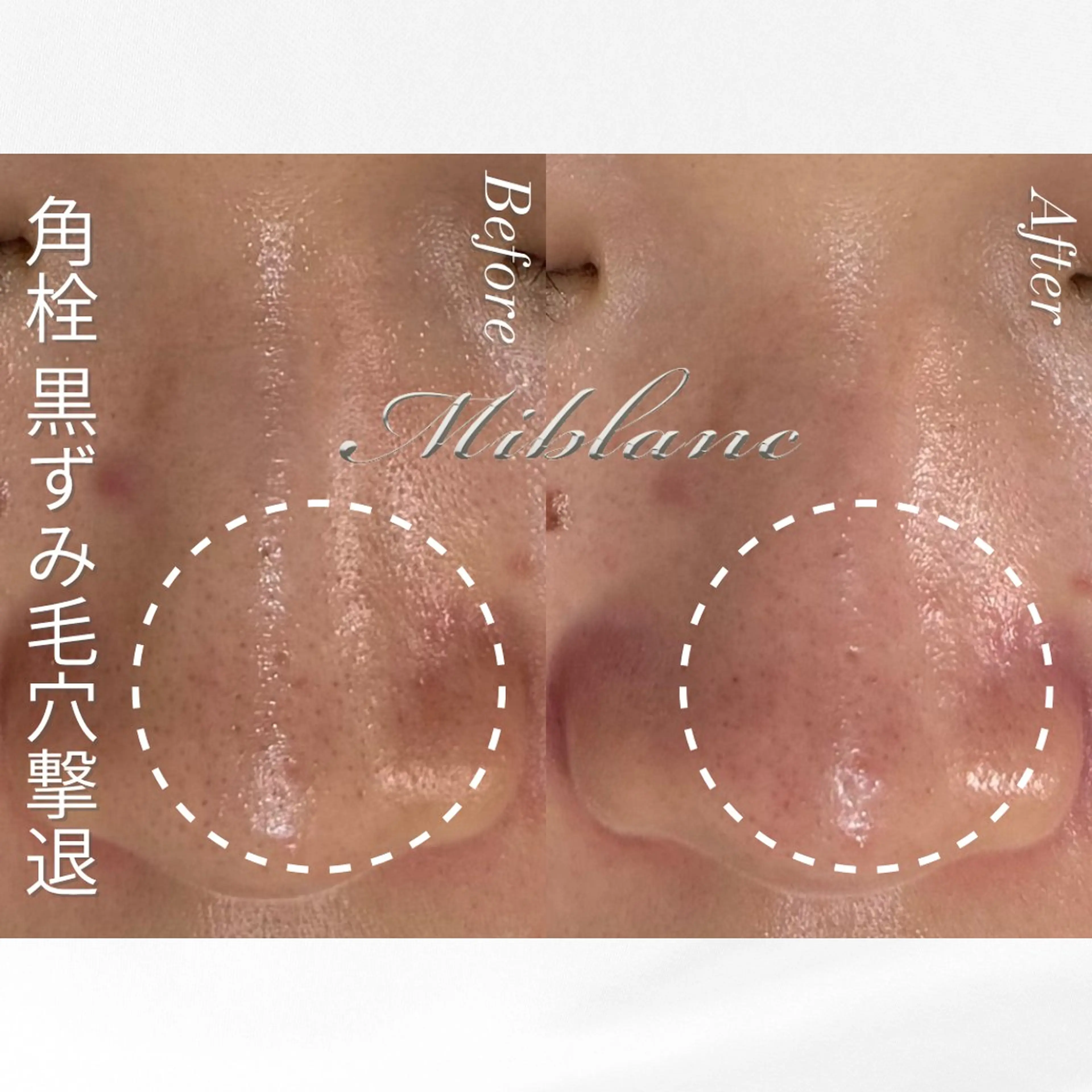 エステ リラク 肌質管理 MIBLANC上野店のエステ・リラクイメージ