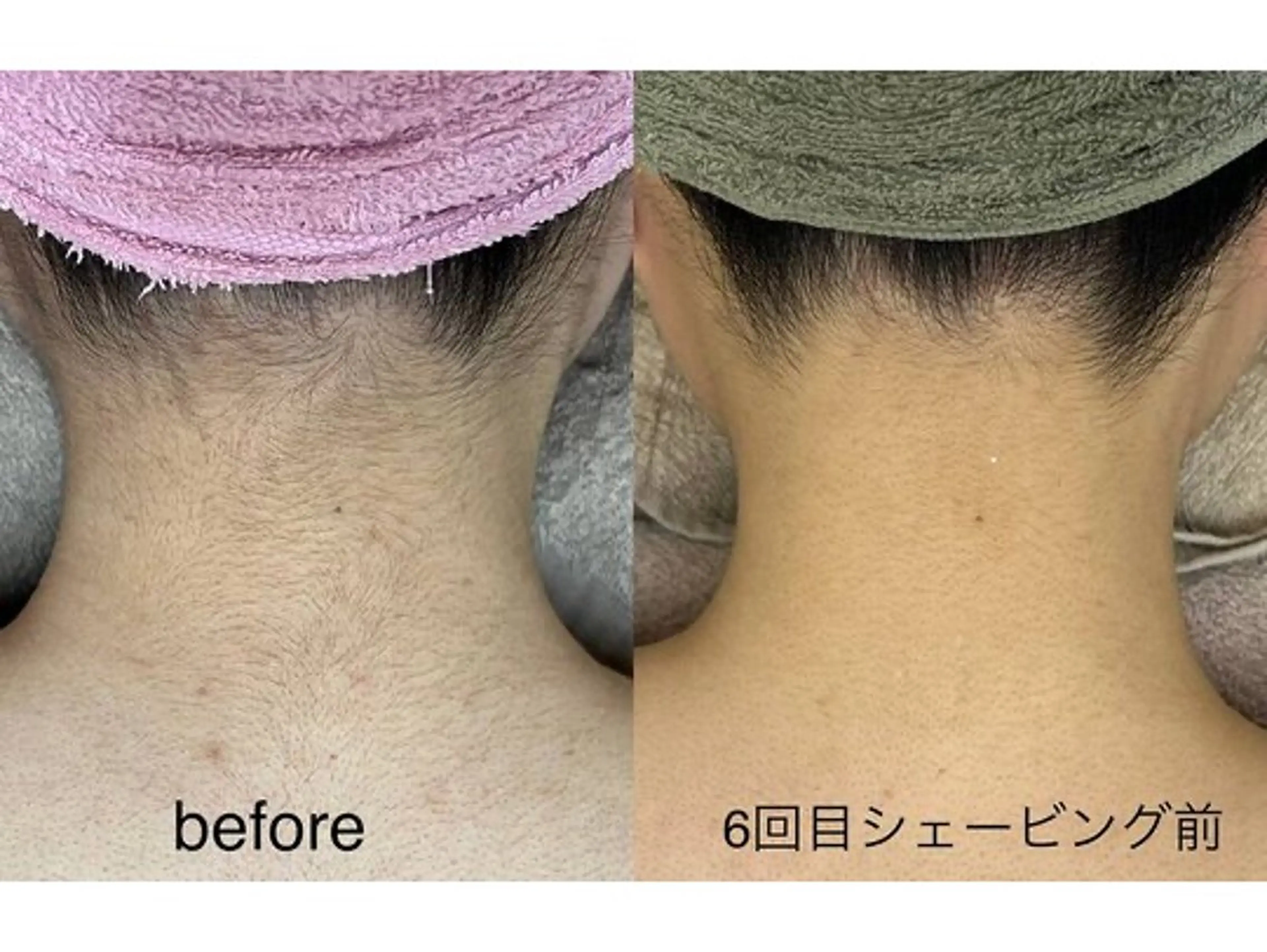 脱毛 【美肌専門 脱毛】 サロンドジェシカのエステ・リラクイメージ