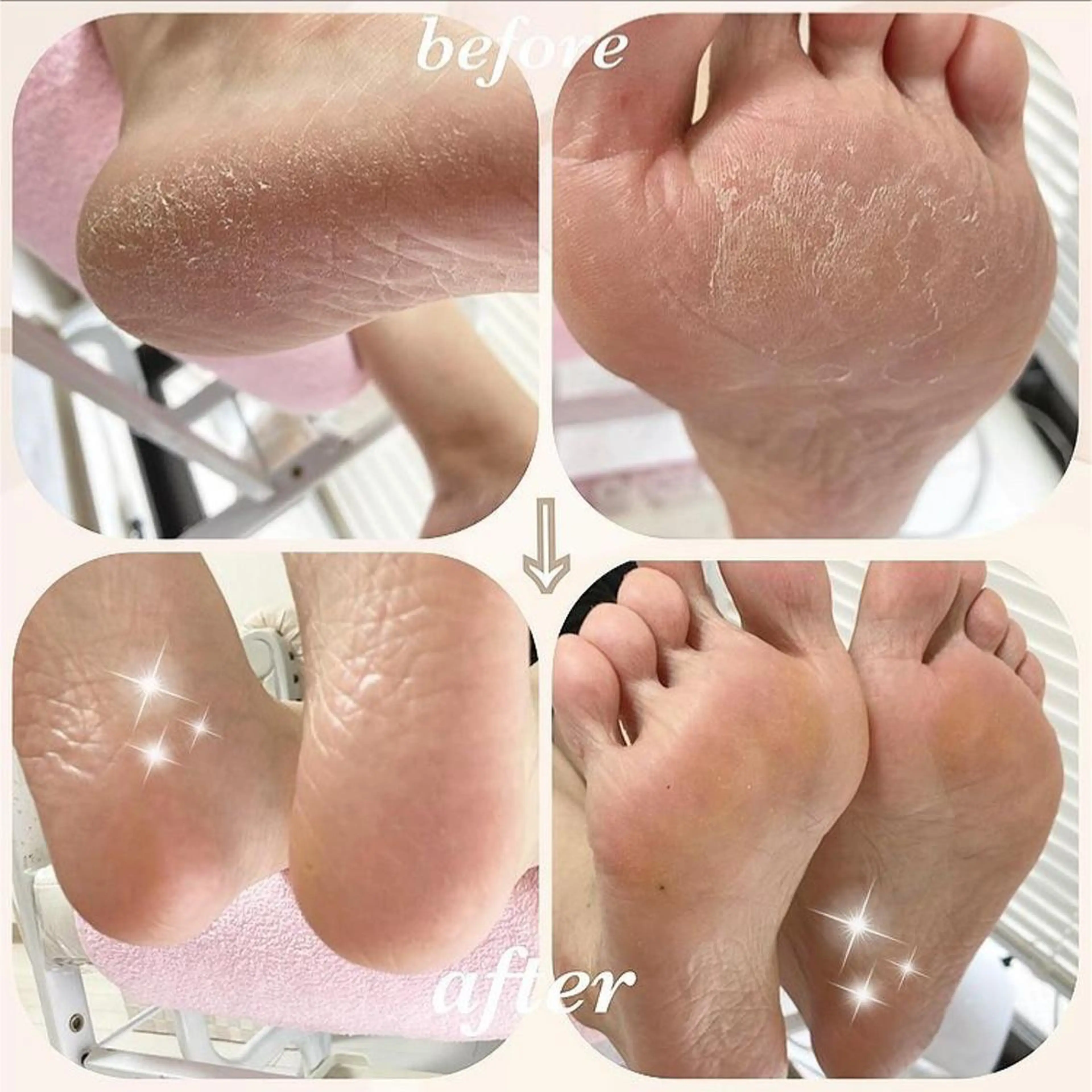 フットネイルの季節に✨OPIプロスパ角質ケア☘️※ハンドorフットの写真