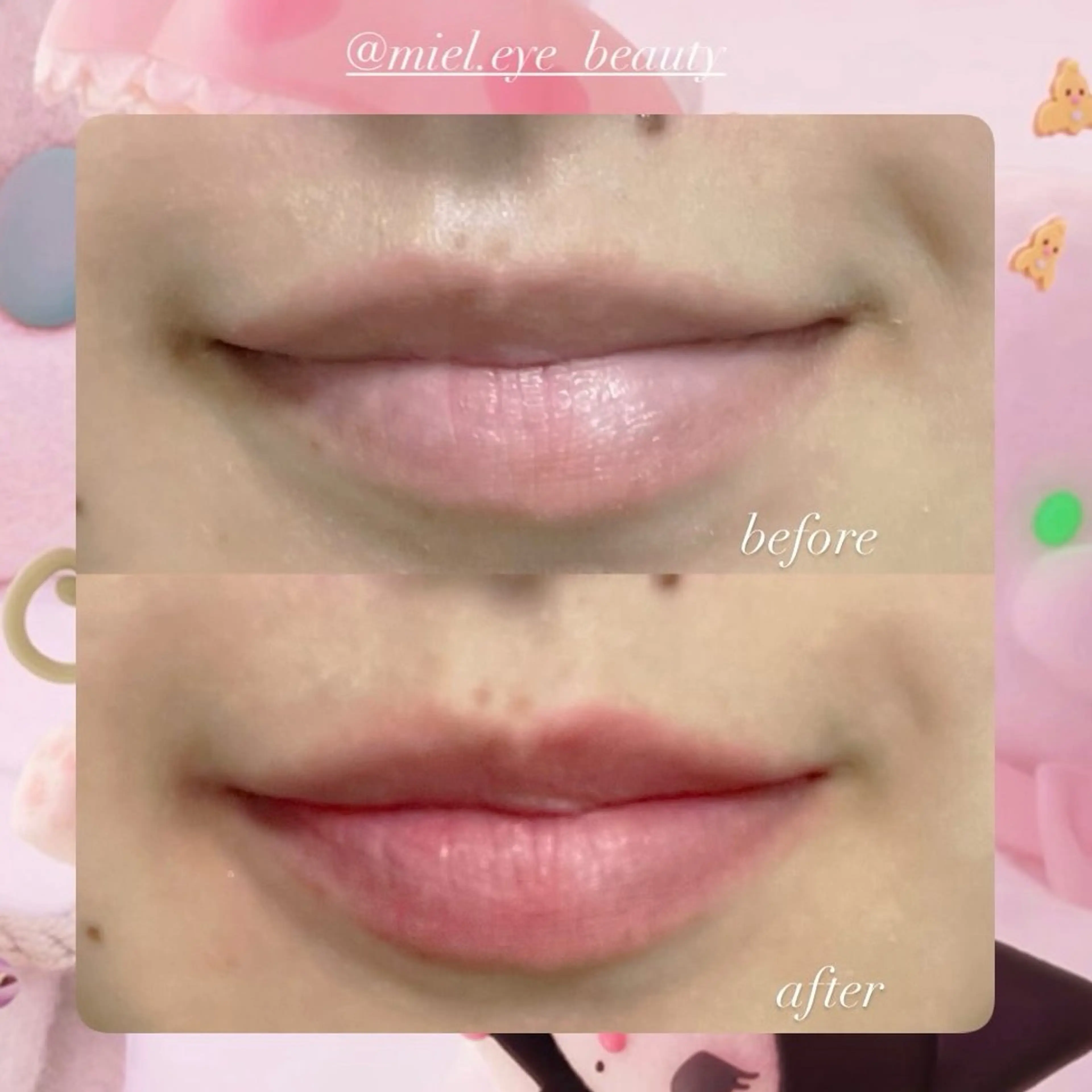🩷新技術《makeup tatoo》リップモデル様募集🩷 理想の唇が続きます◎の写真