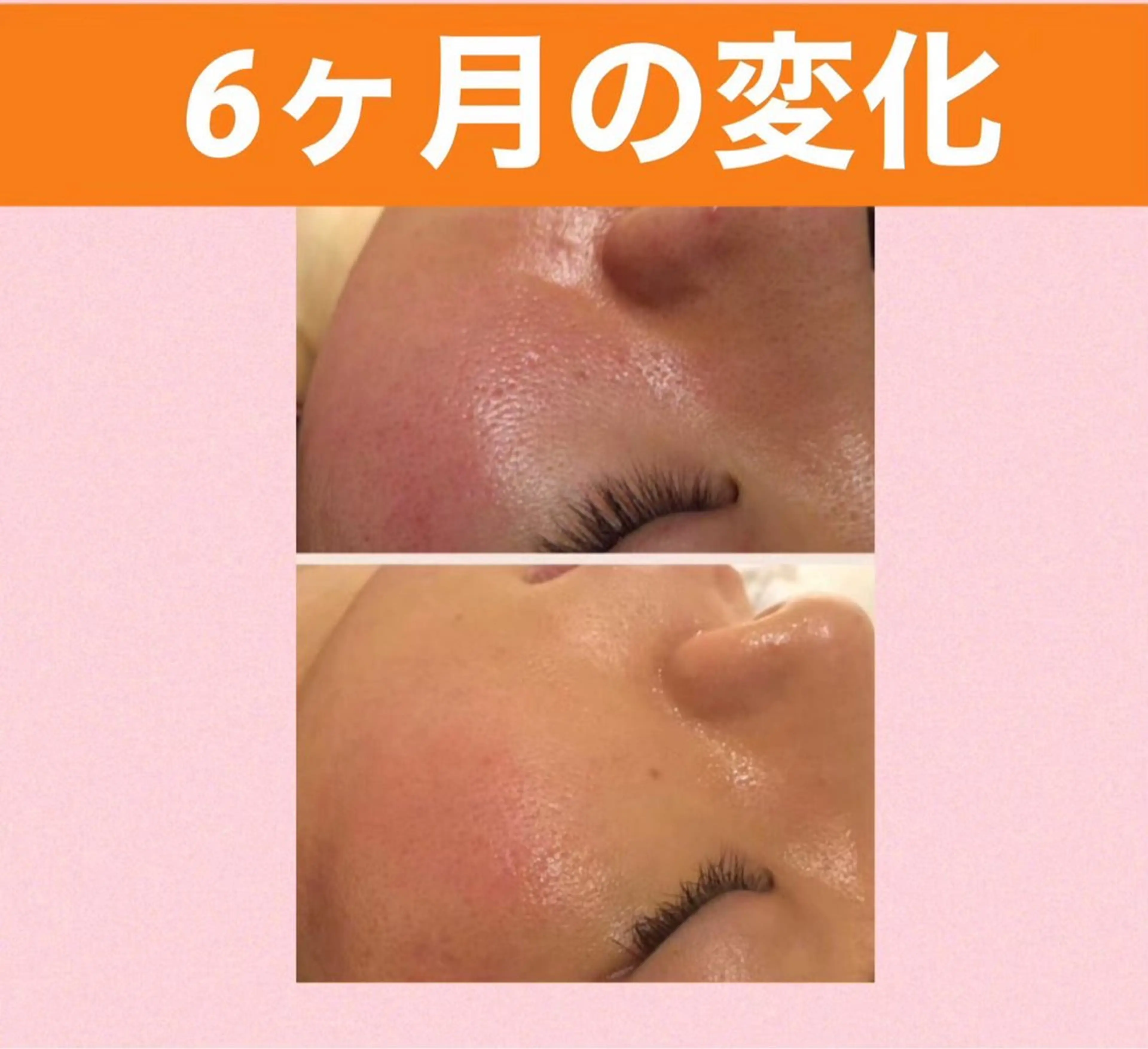 メンズ キッズ ニキビ 専門のエステ・リラクイメージ