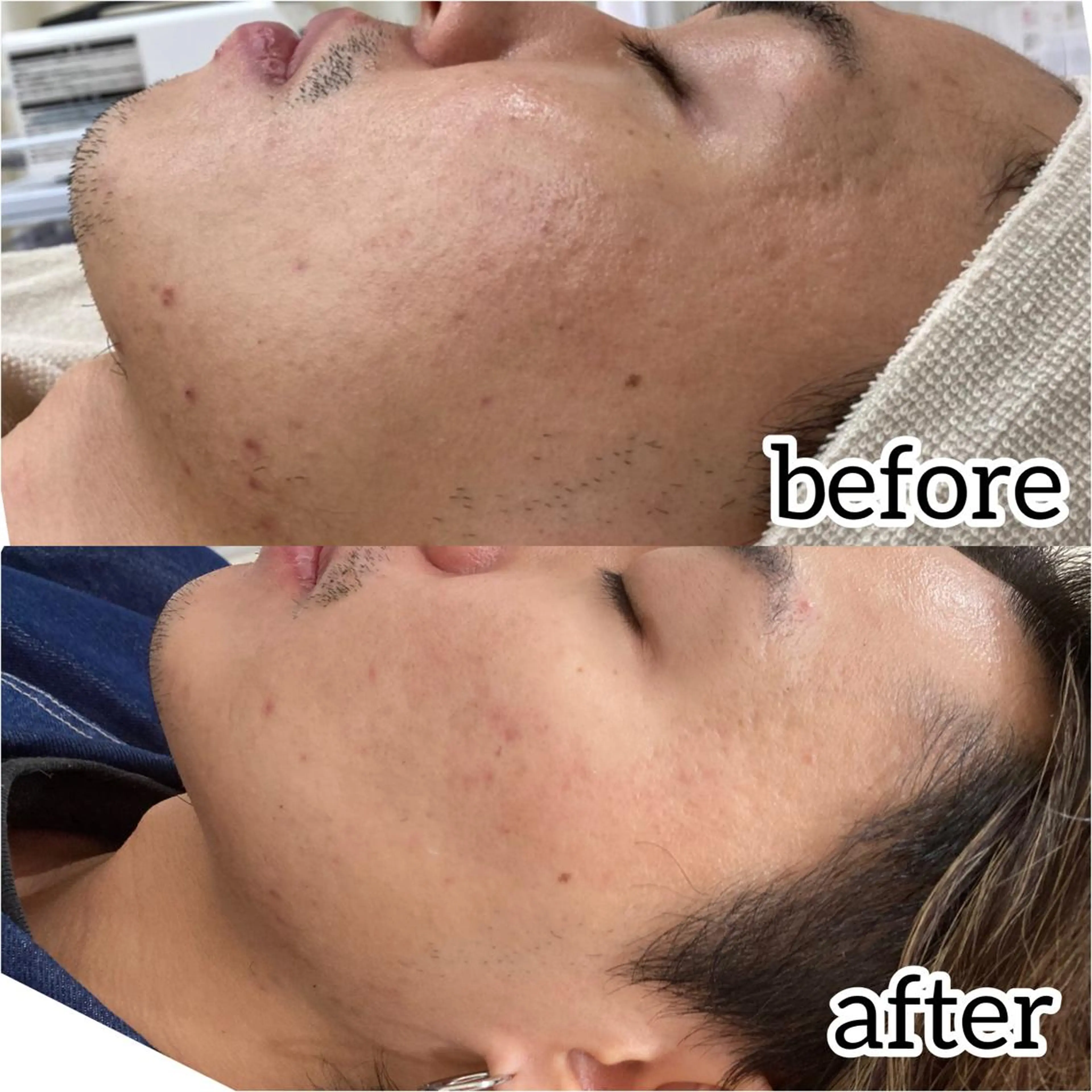 laluna saki...のその他イメージ