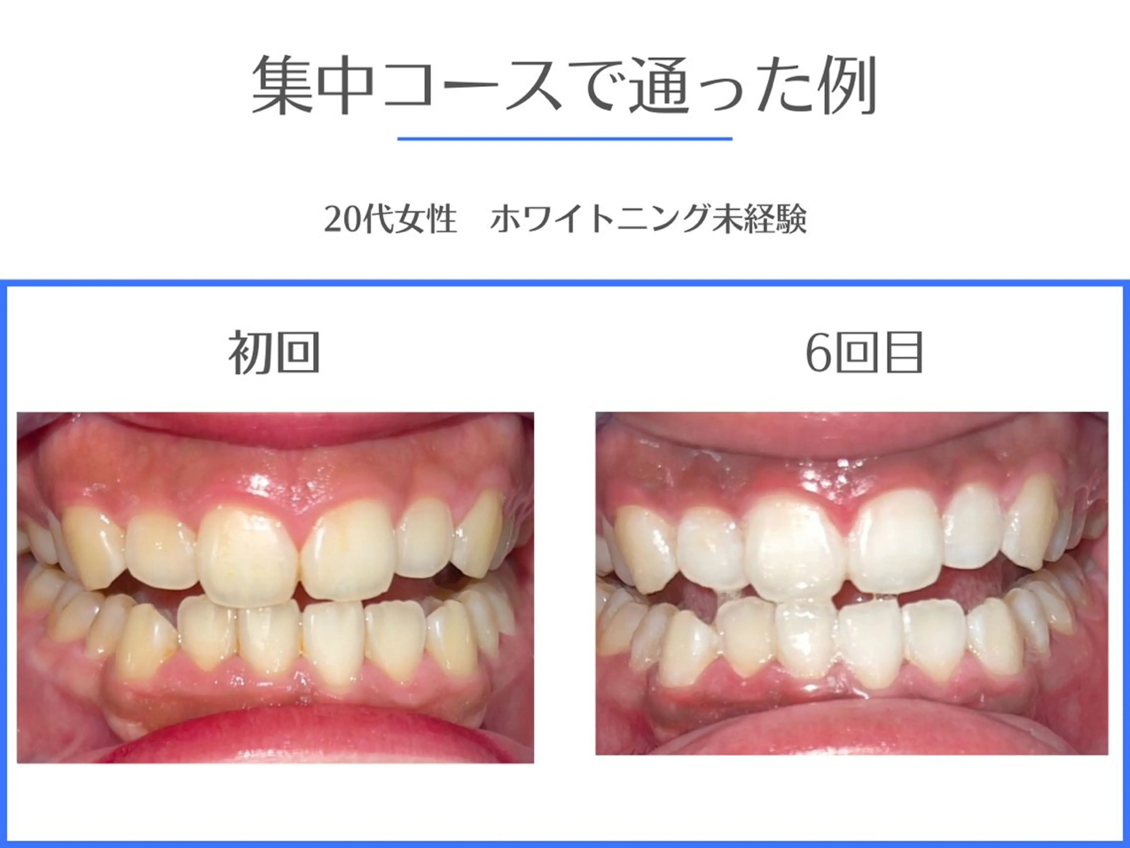 その他 セルフホワイトニング エクシア岡崎店所属・ホワイトニング/脱毛 専門店エクシア岡崎店のその他イメージ