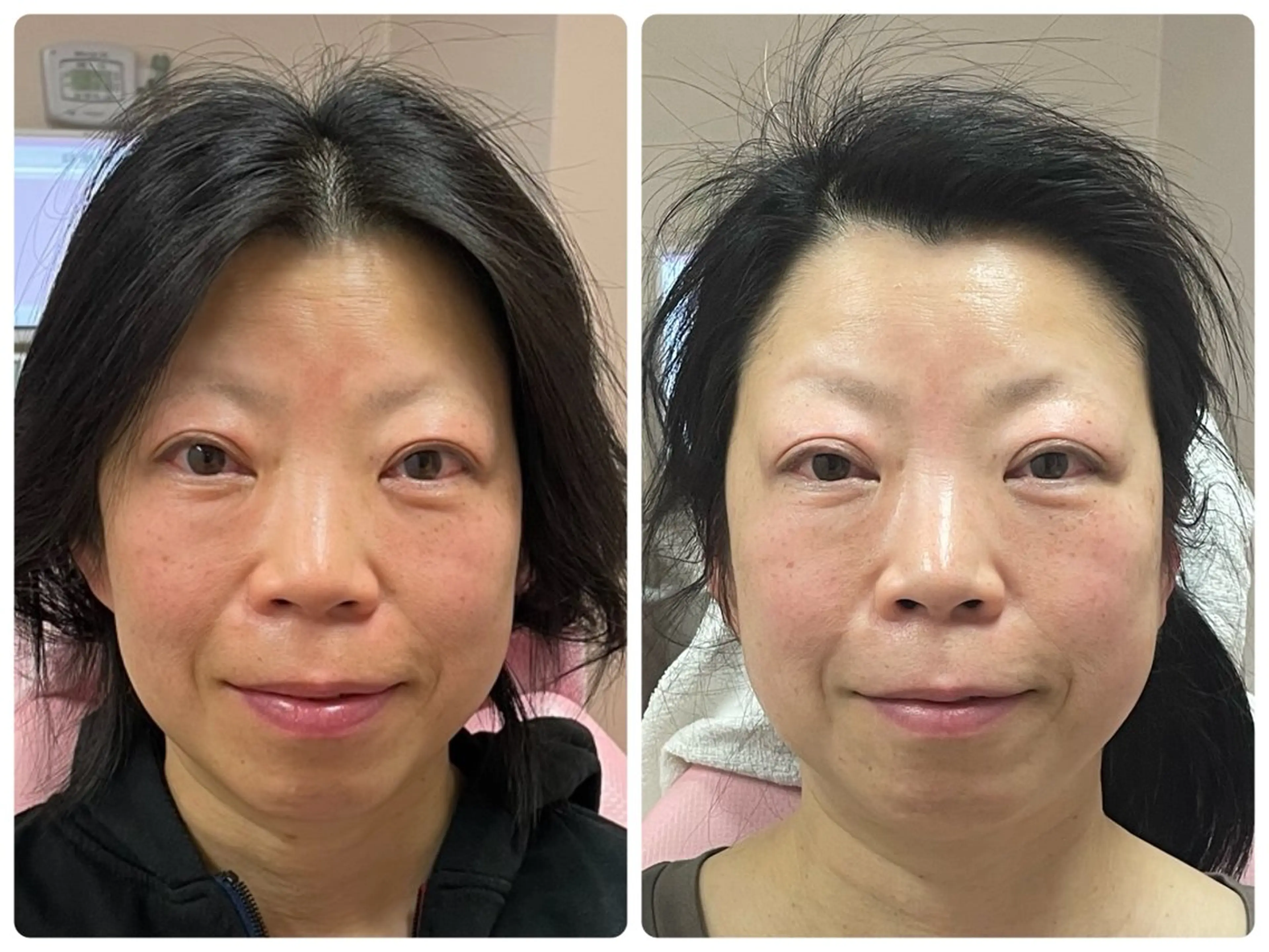 Salon Rion所属・Rion 野々村のエステ・リラクイメージ