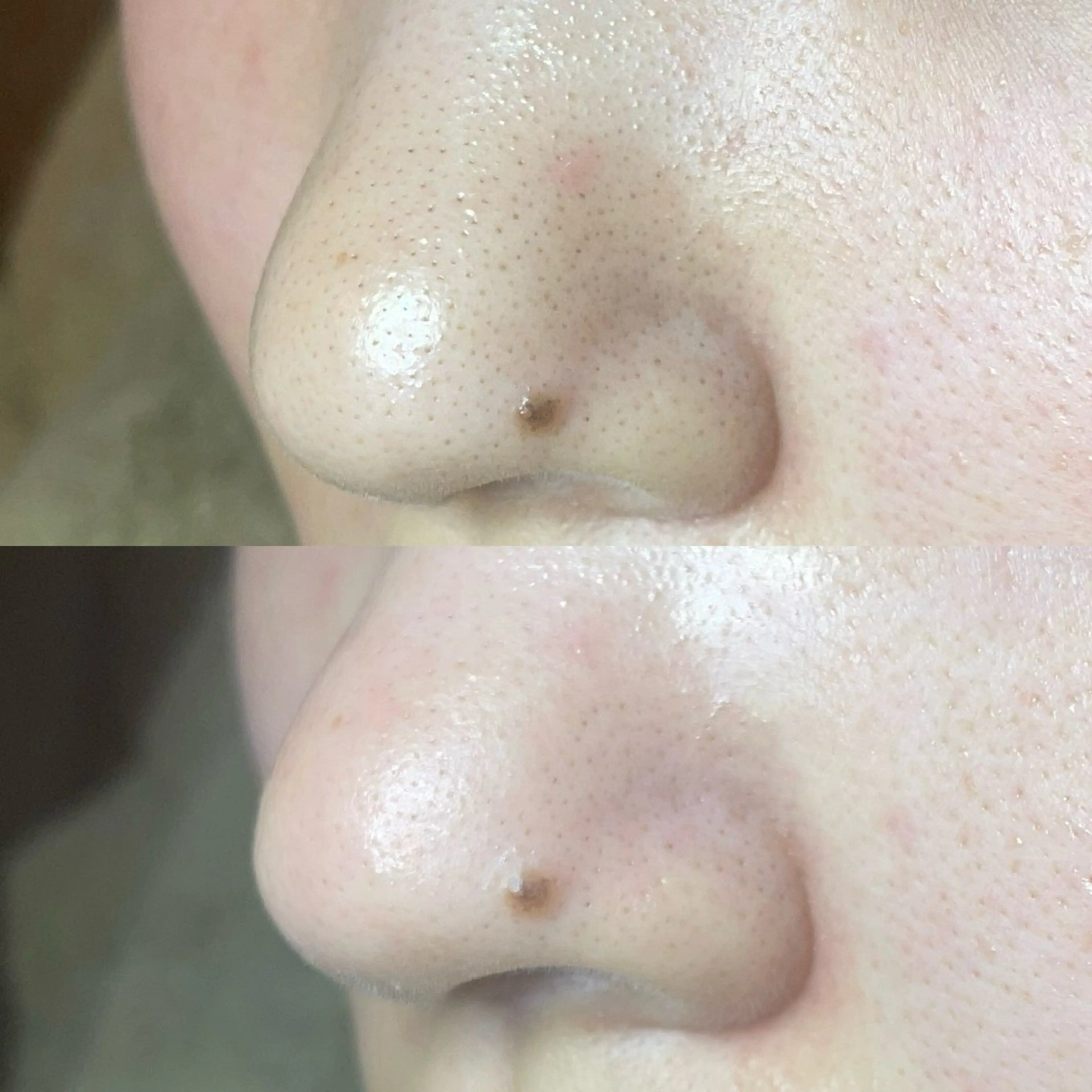 エステ Re:Belle所属・Re:Belle 久留米 : 中島のエステ・リラクイメージ