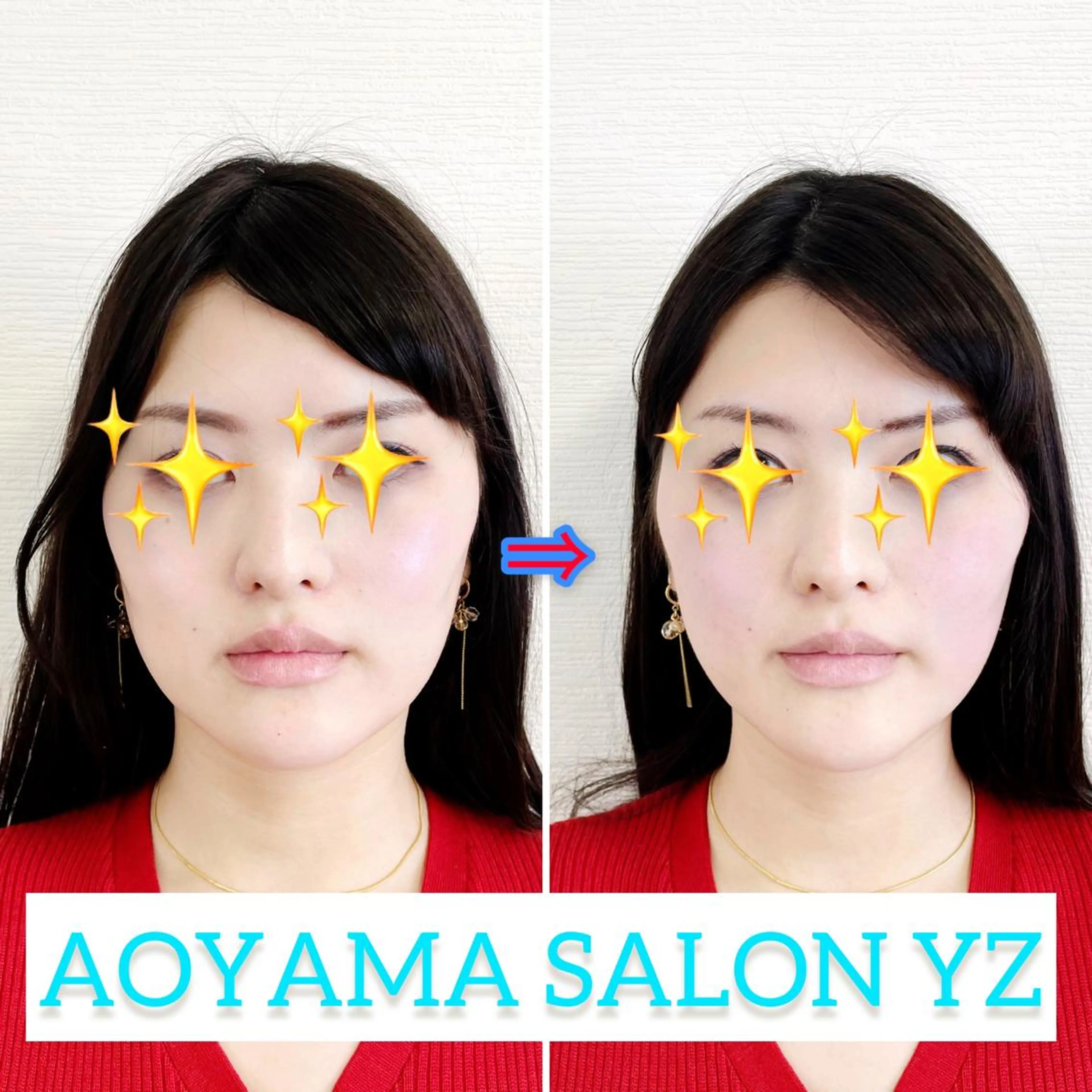 エステ リラク 小顔美容鍼専門サロン 渋谷YZのエステ・リラクイメージ