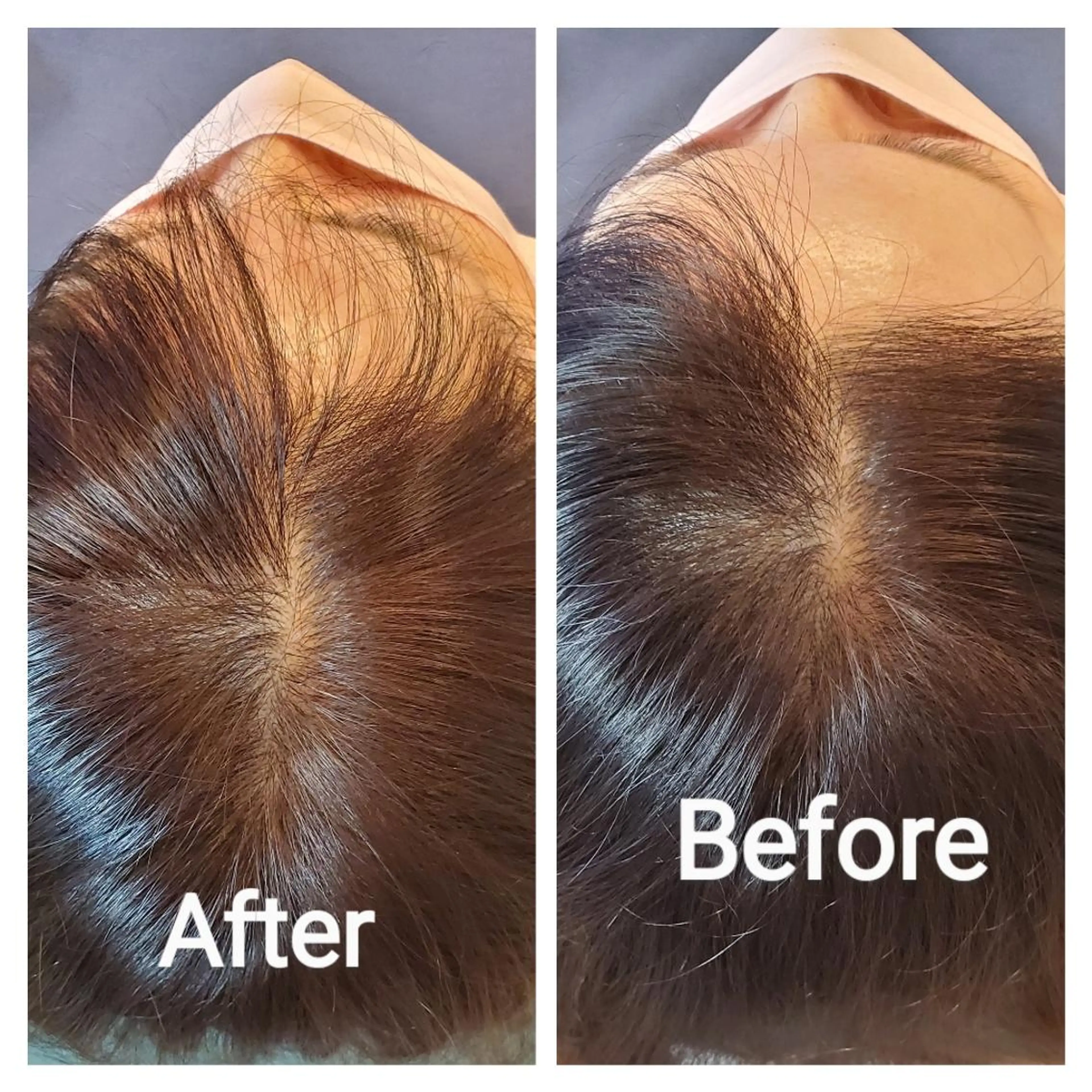 歯科提携セルフダック 宇都宮駒生店のエステ・リラクイメージ