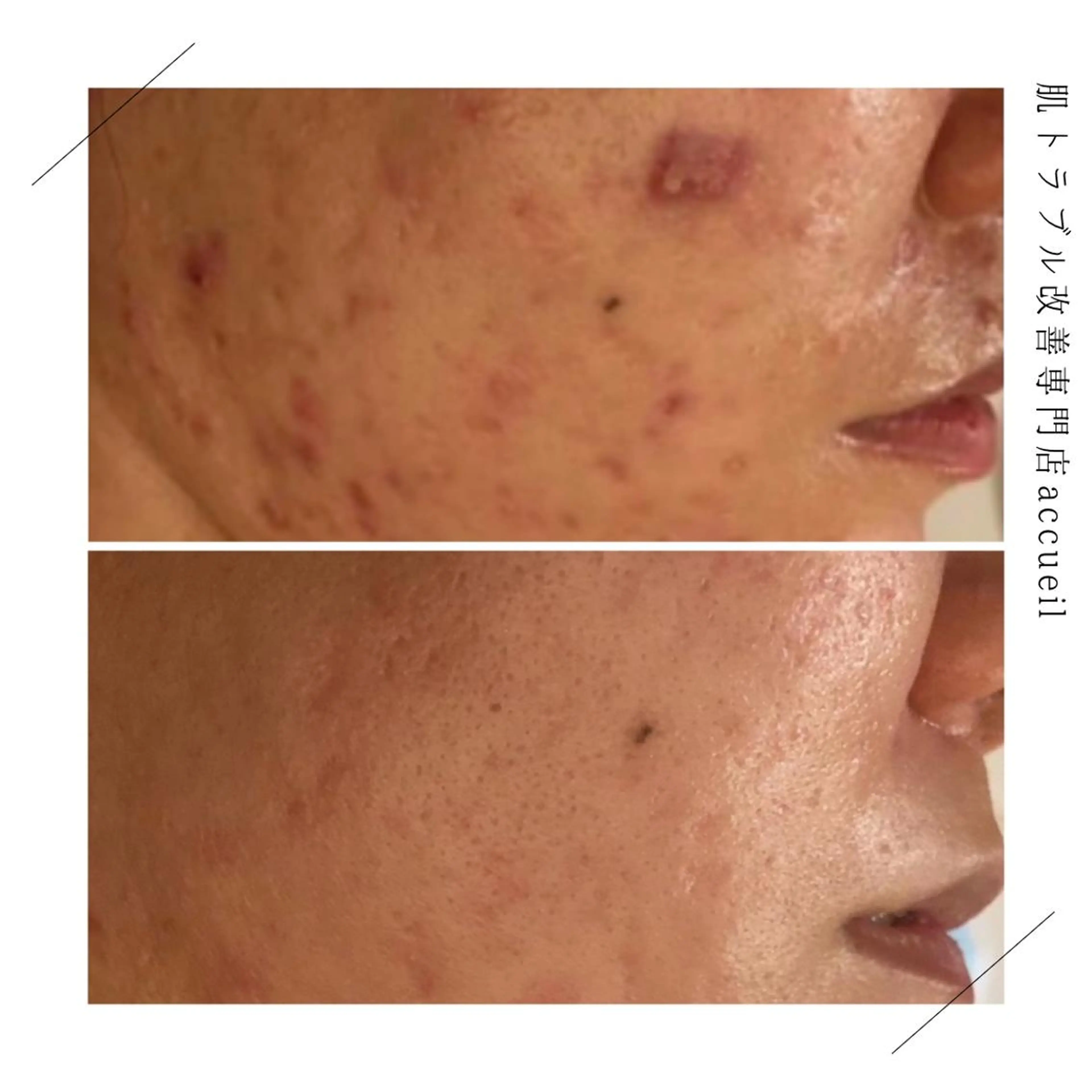 ショート カラー パーマ ヘアアレンジ メンズ キッズ ネイル マツエク・マツパ アイブロウ 触れたくなる モテ肌へ...❤︎のエステ・リラクイメージ