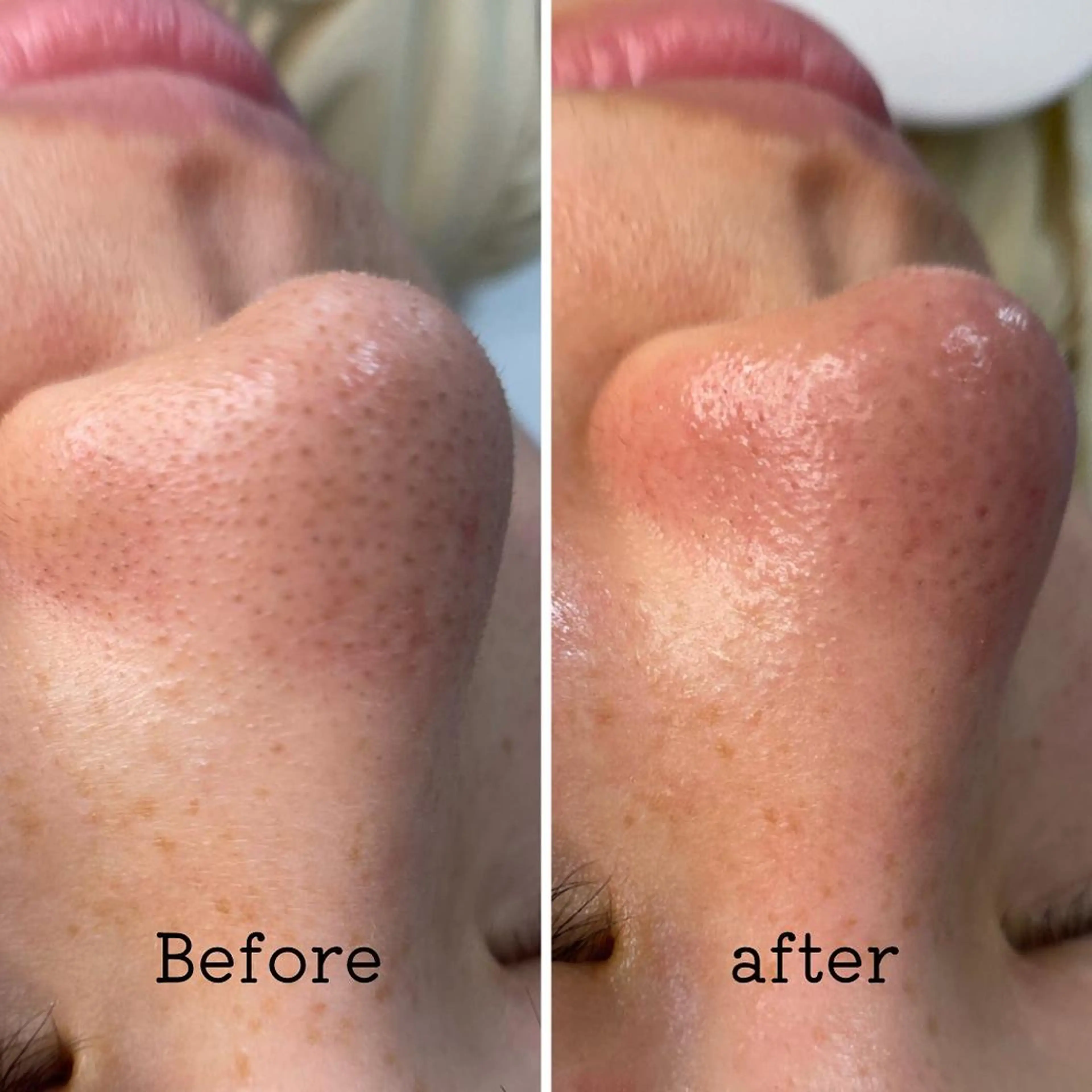 エステ É LINDA所属・E LINDAのネイルデザイン