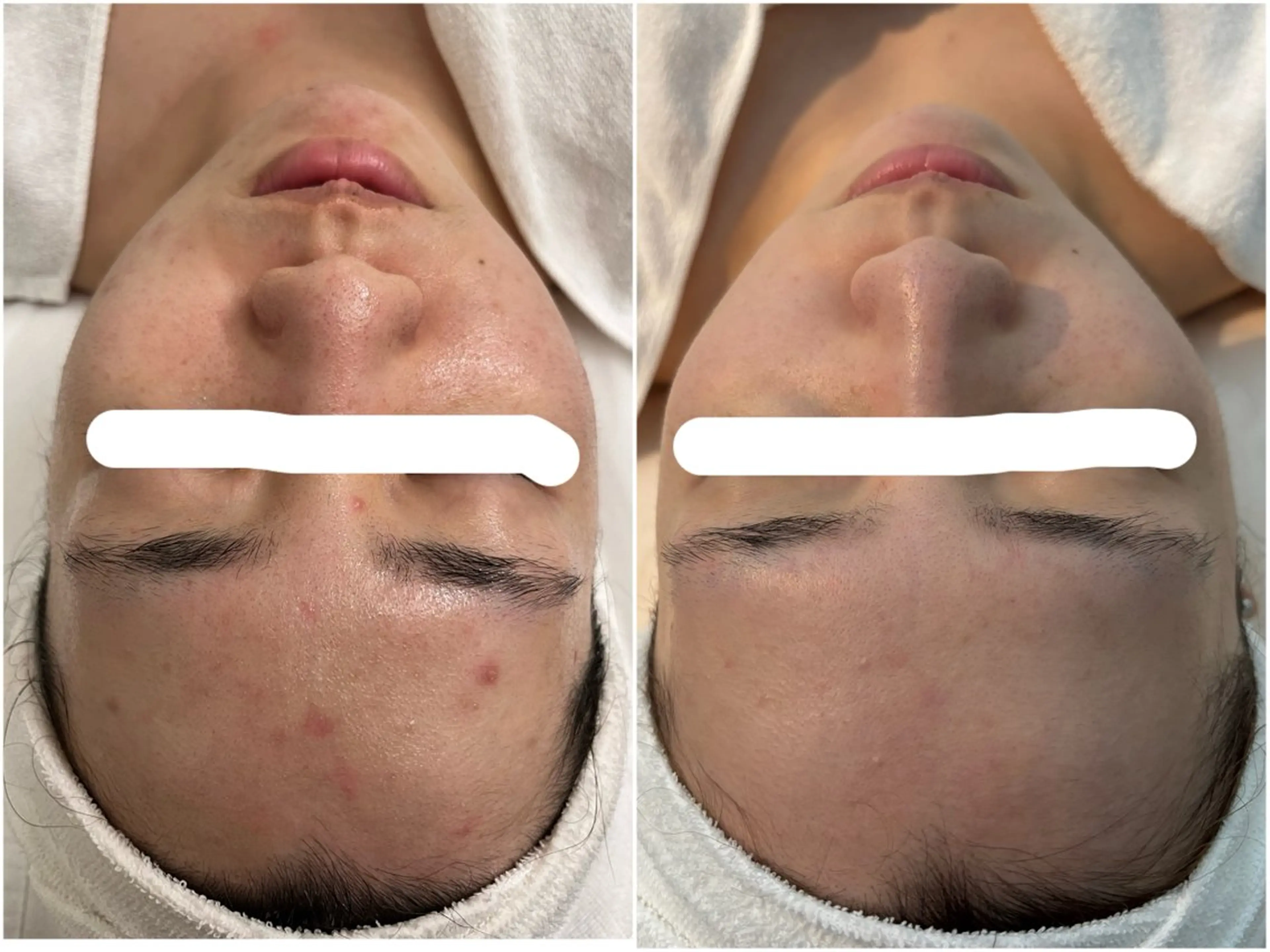 デ・アイム心斎橋所属・肌質改善サロン🫧 MAIのエステ・リラクイメージ