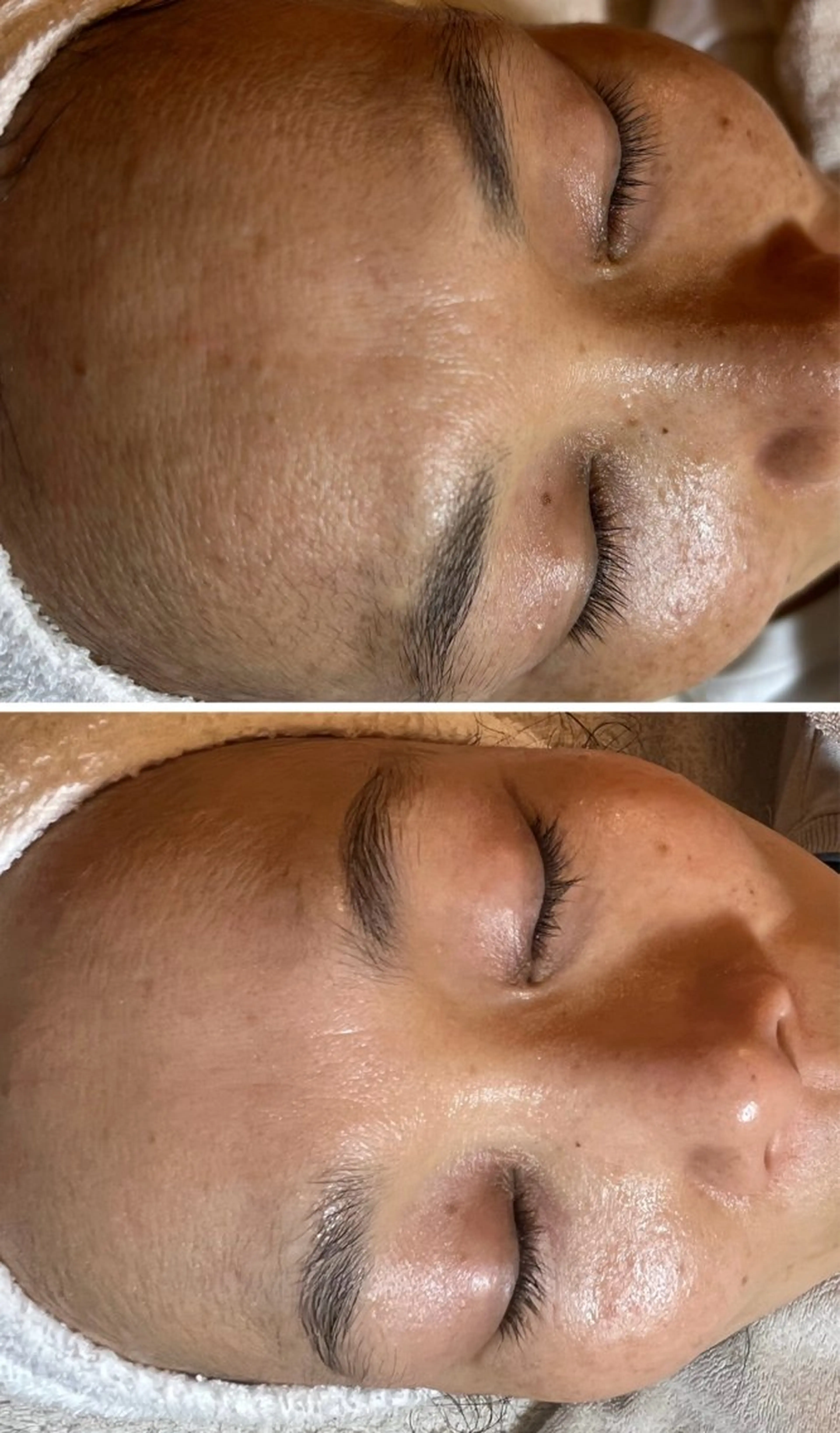 esty hitomiのエステ・リラクイメージ