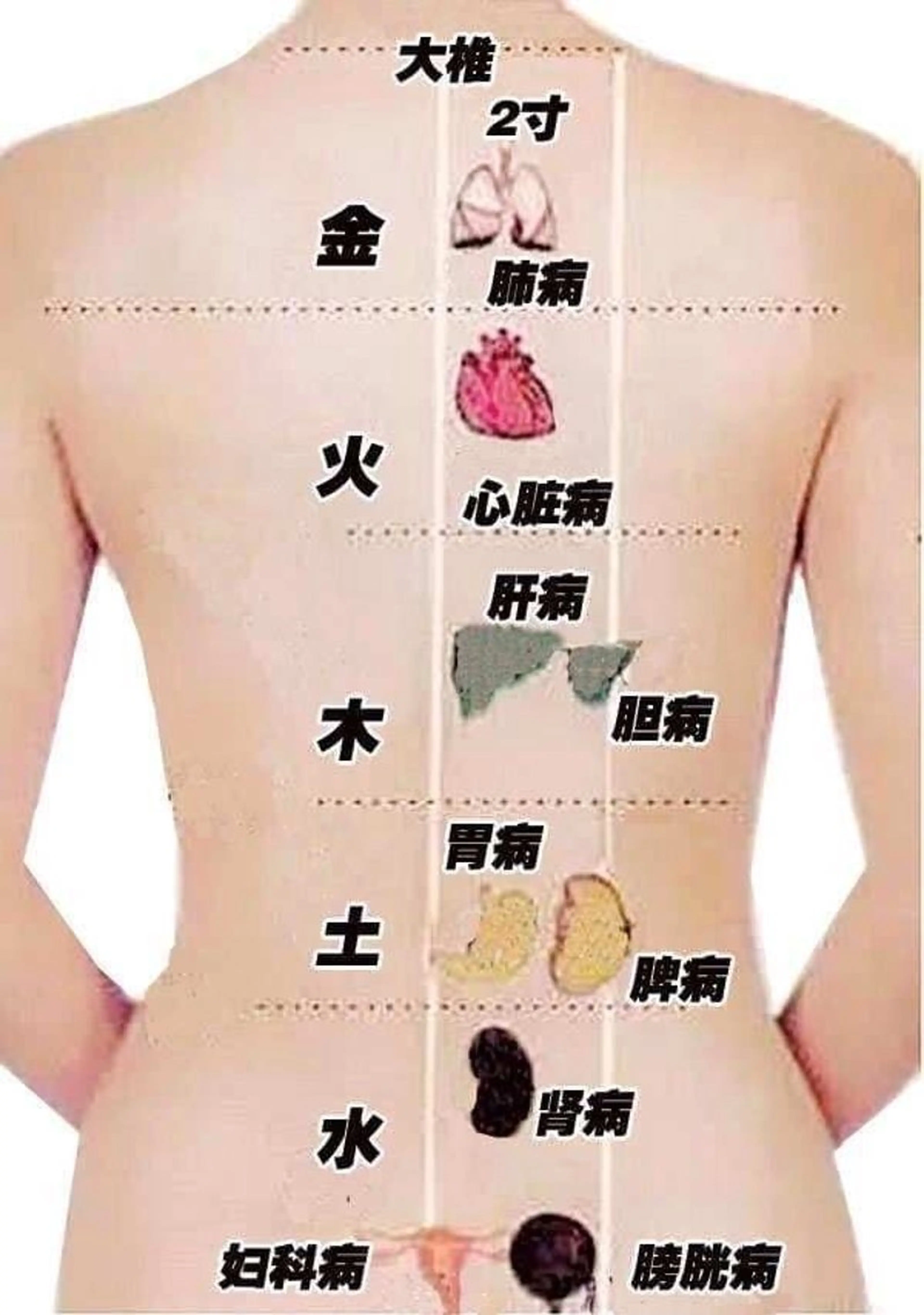 背中ほぐし　肩こりの写真