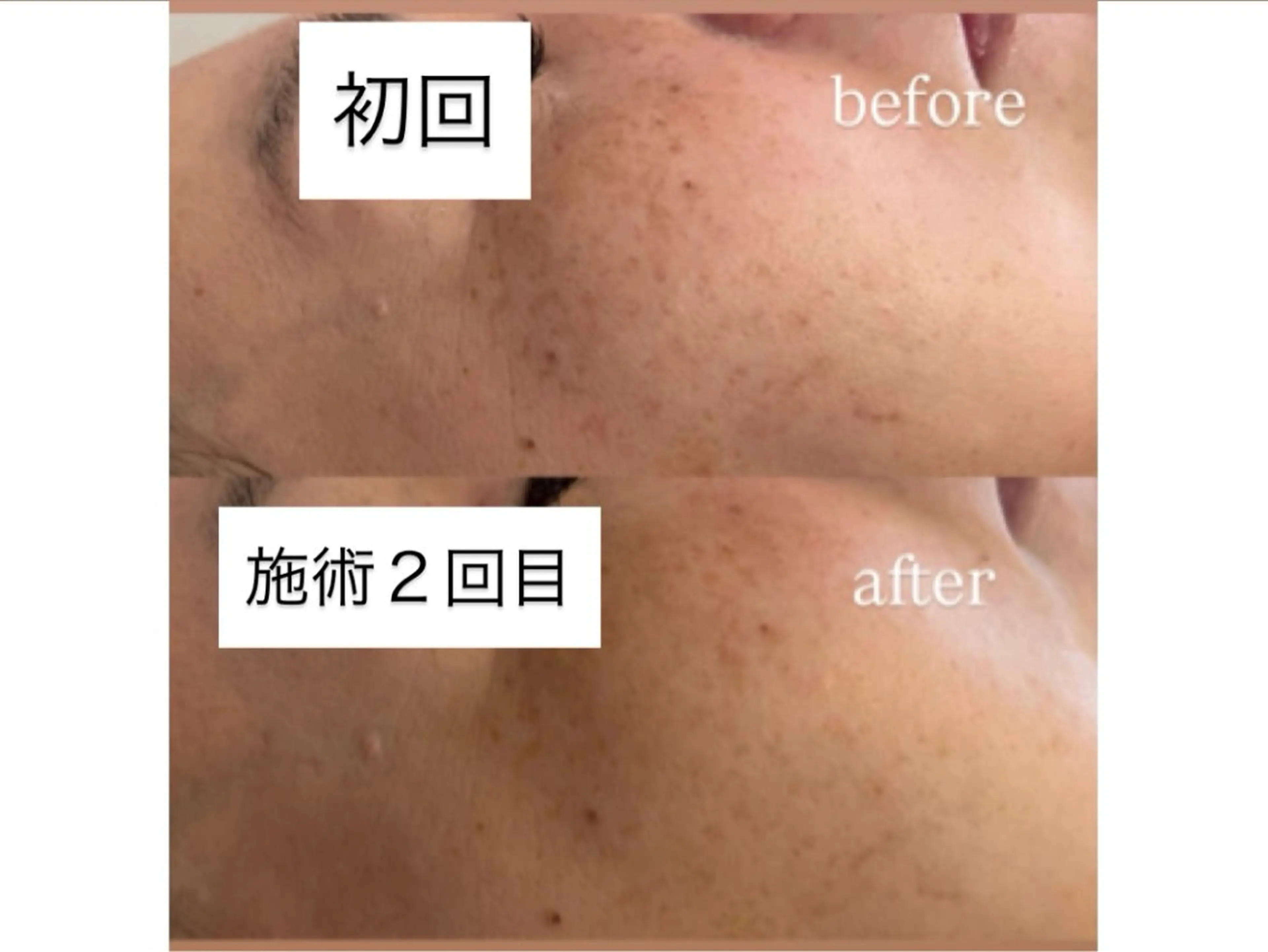 salon＿drop所属・salon dropのエステ・リラクイメージ