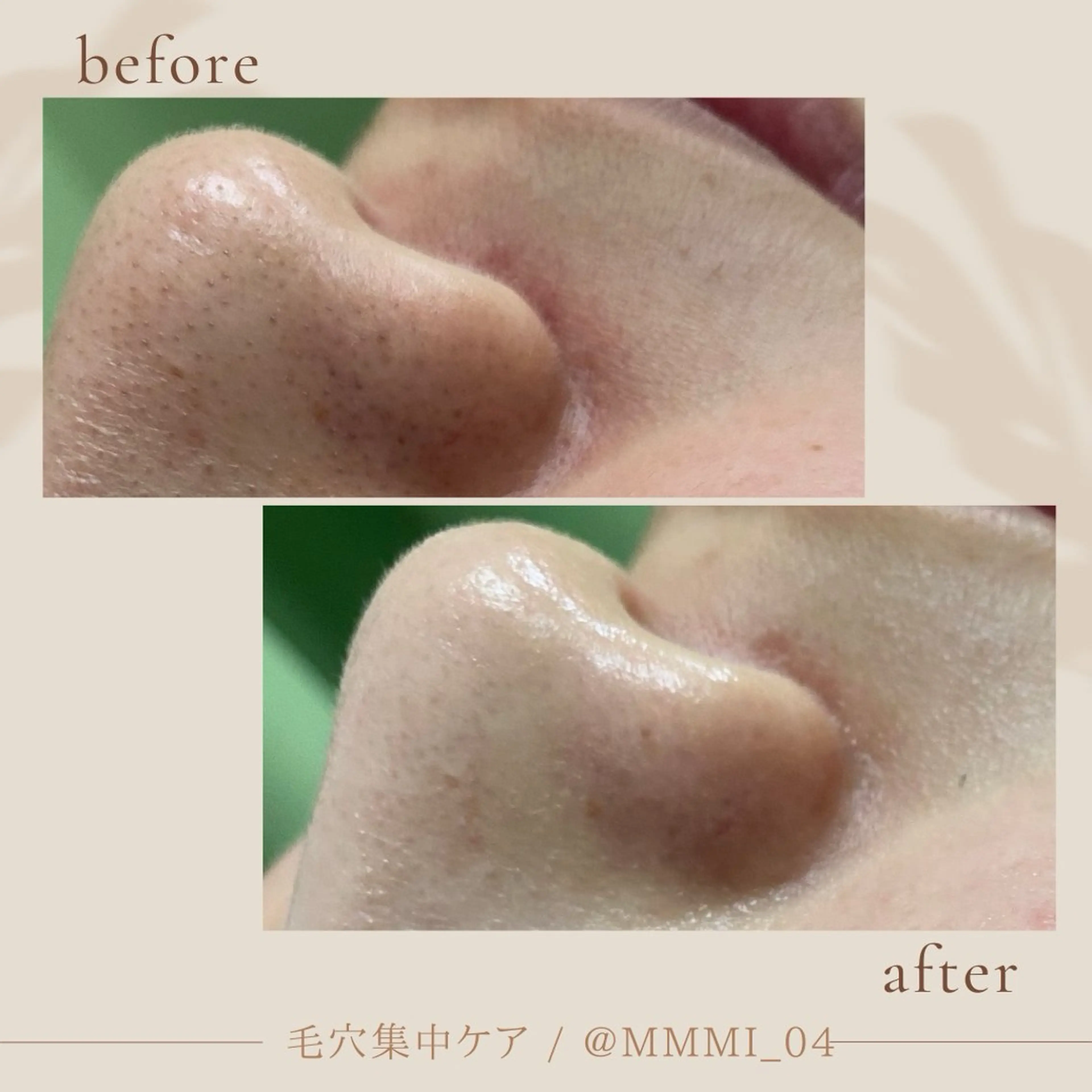 デ・アイム新潟北所属・サイトウ .のエステ・リラクイメージ