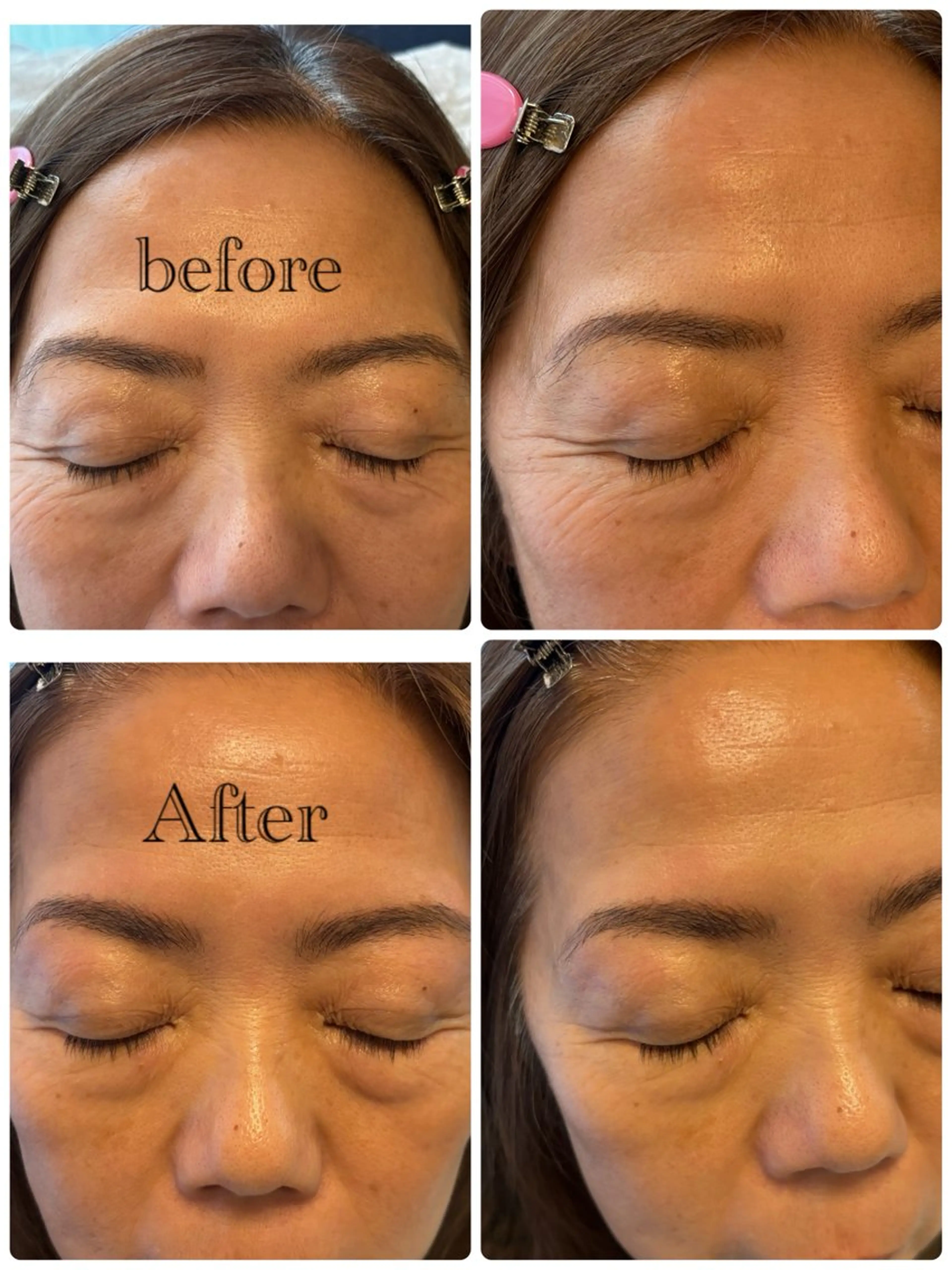 アイブロウ ハリウッドブロウリフト ワックス脱毛 その他(アイブロウ) MIKA ♡のネイルデザイン