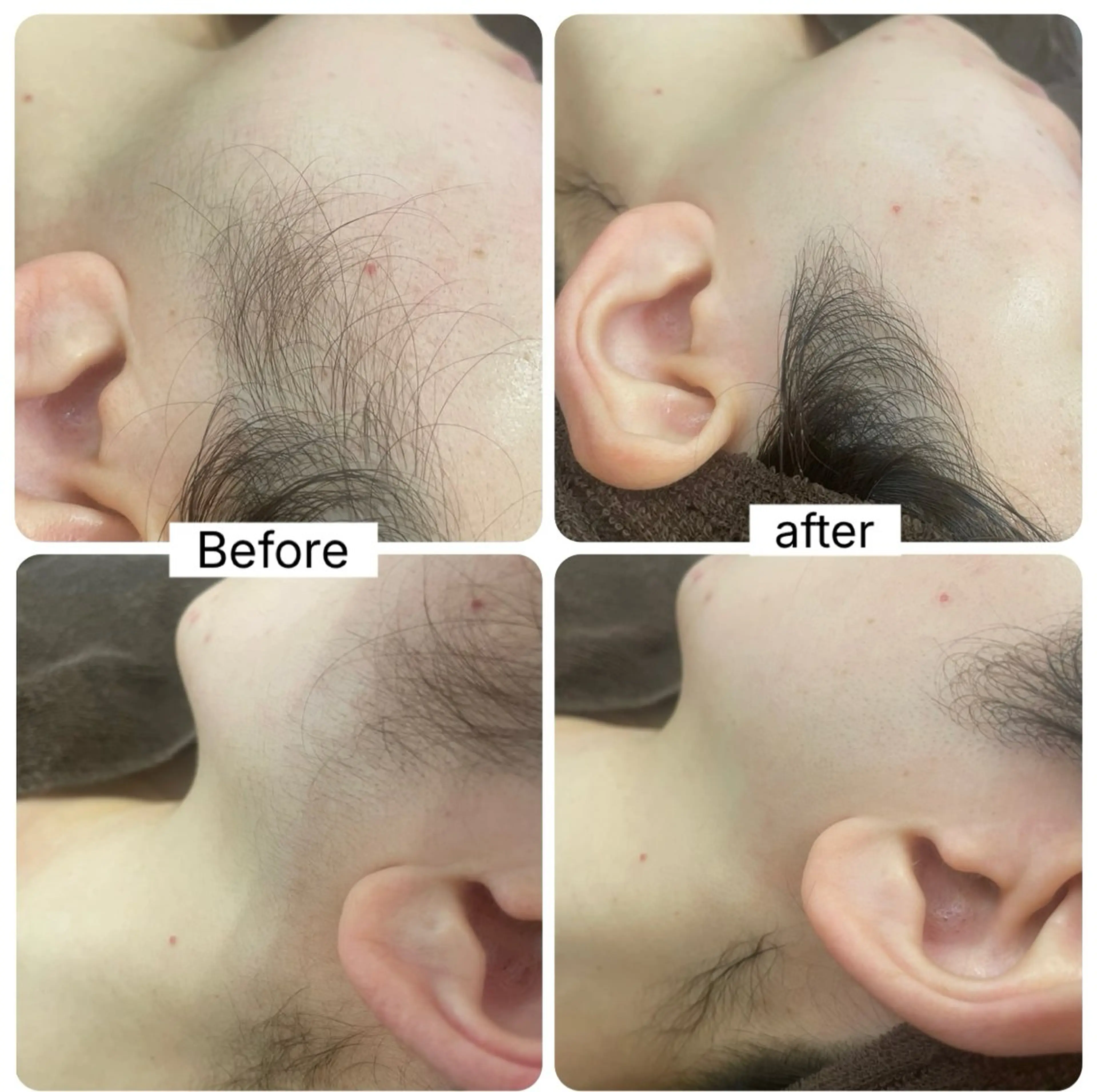 お顔+襟足+ヘッドマッサージ(20分)の写真